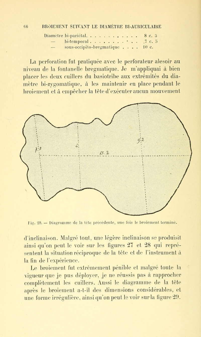 Diamètre bi-pariétal 8 c. 5 — bi-temporal • . . .7 c. 3 — sous-occipito-bregmatique .... 10 c. La perforation fut pratiquée avec le perforateur alesoir au niveau de la fontanelle bregmatique. Je m'appliquai à bien placer les deux cuillers du basiotribe aux extrémités du dia- mètre bi-zygomatique, à les maintenir en place pendant le broiement et à empêcher la tête d'exécuter aucun mouvement Fig. 29. — Diagramme de la tête précédente, irne fois le broiement terminé. d'inclinaison. Malgré tout, une légère inclinaison se produisit ainsi qu'on peut le voir sur les figures 27 et 28 qui repré- sentent la situation réciproque de la tête et de l'instrument à la fin de l'expérience. Le broiement fut extrêmement pénible et malgré toute la vigueur que je pus déployer, je ne réussis pas à rapprocher complètement les cuillers. Aussi le diagramme de la tête après le broiement a-t-il des dimensions considérables, et une forme irréguhère, ainsi qu'on peut le voir sur la figure 20.