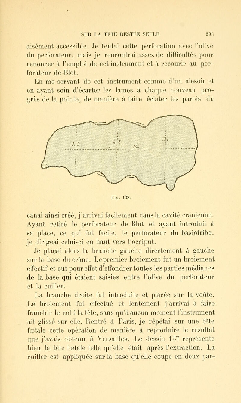 aisément accessible. Je tentai cette perforation avec l'olive du perforateur, mais je rencontrai assez de difficultés pour renoncer à l'emploi de cet instrument et à recourir au per- forateur de-Blot. En me servant de cet instrument comme d'un alesoir et en ayant soin d'écarter les lames à chaque nouveau pro- grès de la pointe, de manière à faire éclater les parois du Fio-. 138. canal ainsi créé, j'arrivai facilement dans la cavité crânienne. Ayant retiré le perforateur de Blot et ayant introduit à sa place, ce qui fut facile, le perforateur du basiotribe, je dirigeai celui-ci en haut vers l'occiput. Je plaçai alors la branche gauche directement à gauche sur la base du crâne. Le premier broiement fut un broiement effectif et eut pour effet d'effondrer toutes les parties médianes de la base qui étaient saisies entre l'olive du perforateur et la cuiller. La branche droite fut introduite et placée sur la voûte. Le broiement fut effectué et lentement j'arrivai à faire franchir le col à la tête, sans qu'à aucun moment l'instrument ait glissé sur elle. Rentré à Paris, je répétai sur une tête fœtale cette opération de manière à reproduire le résultat que j'avais obtenu à Versailles. Le dessin 137 représente bien la tête fœtale telle qu'elle était après l'extraction. La cuiller est appliquée sur la base qu'elle coupe en deux par-