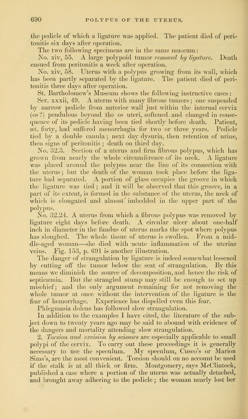 the pedicle of which a ligature was applied. The patient died of peri- tonitis six days after operation. The two following specimens are in the same museum: No. xiv, 55. A large polypoid tumor removed by ligature. Death ensued from peritonitis a week after operation. No. xiv, 58. Uterus with a polypus growing from its wall, which has been partly separated by the ligature. The patient died of peri- tonitis three days after operation. St. Bartholomew's Museum shows the following instructive cases: Ser. xxxii, 49. A uterus with many fibrous tumors; one suspended by narrow pedicle from anterior wall just within the internal cervix (os?) pendulous beyond the os uteri, softened, and changed in conse- quence of its pedicle having been tied shortly before death. Patient, set. forty, had suffered menorrhagia for two or three years. Pedicle tied by a double canula; next day dysuria, then retention of urine, then signs of peritonitis ; death on third day. No. 32.3. Section of a uterus and firm fibrous polypus, which has grown from nearly the whole circumference of its neck. A ligature was placed around the polypus near the line of its connection with the uterus; but the death of the woman took place before the liga- ture had separated. A portion of glass occupies the groove in which the ligature was tied; and it will be observed that this groove, in a part of its extent, is formed in the substance of the uterus, the neck of which is elongated and almost' imbedded in the upper part of the polypus. No. 32.24. A uterus from which a fibrous polypus was removed by ligature eight days before death. A circular ulcer about one-half inch in diameter in the fundus of uterus marks the spot where polypus has sloughed. The whole tissue of uterus is swollen. From a mid- dle-aged woman—she died with acute inflammation of the uterine veins. Fig. 153, p. 691 is another illustration. The danger of strangulation by ligature is indeed somewhat lessened by cutting off the tumor below the seat of strangulation. By this means we diminish the source of decomposition, and hence the risk of septicaemia. But the strangled stump may still be enough to set up mischief; and the only argument remaining for not removing the whole tumor at once without the intervention of the ligature is the fear of hemorrhage. Experience has dispelled even this fear. Phlegmasia dolens has followed slow strangulation. In addition to the examples I have cited, the literature of the sub- ject down to twenty years ago may be said to abound with evidence of the dangers and mortality attending slow strangulation. 2. Torsion and excision by scissors are especially applicable to small polypi of the cervix. To carry out these proceedings it is generally necessary to use the speculum. My speculum, Cusco's or Marion Sims's, are the most convenient. Torsion should on no account be used if the stalk is at all thick or firm. Montgomery, says McClintock, published a case where a portion of the uterus was actually detached, and brought away adhering to the pedicle; the woman nearly lost her