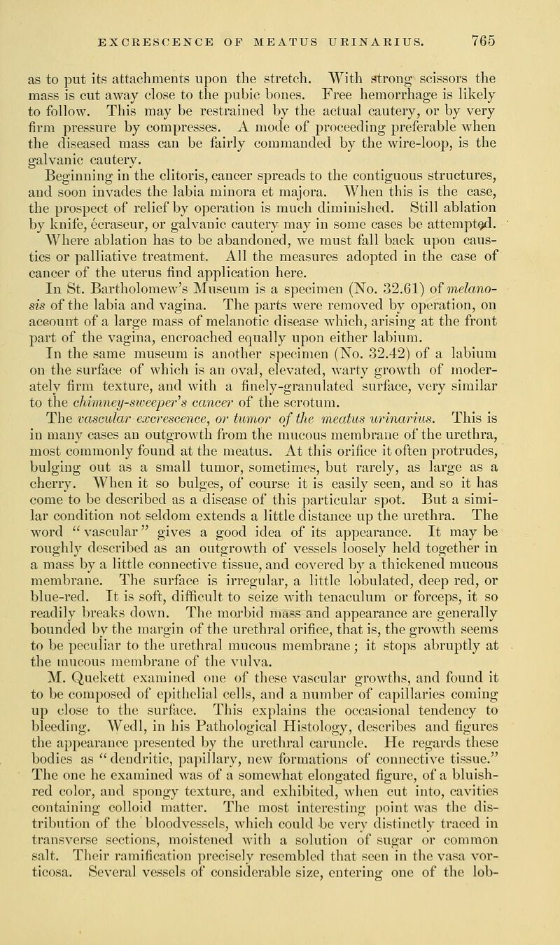 as to put its attachments upon the stretch. With strong scissors the mass is cut away close to the pubic bones. Free hemorrhage is likely to follow. This may be restrained by the actual cautery, or by very firm pressure by compresses. A mode of proceeding preferable when the diseased mass can be fairly commanded by the wire-loop, is the galvanic cautery. Beginning in the clitoris, cancer spreads to the contiguous structures, and soon invades the labia minora et majora. When this is the case, the prospect of relief by operation is much diminished. Still ablation by knife, ecraseur, or galvanic cautery may in some cases be attempted. Where ablation has to be abandoned, we must fall back upon caus- tics or palliative treatment. All the measures adopted in the case of cancer of the uterus find application here. In St. Bartholomew's Museum is a specimen (No. 32.61) of melano- sis of the labia and vagina. The parts were removed by operation, on account of a large mass of melanotic disease which, arising at the front part of the vagina, encroached equally upon either labium. In the same museum is another specimen (No. 32.42) of a labium on the surface of which is an oval, elevated, warty growth of moder- ately firm texture, and with a finely-granulated surface, very similar to the chimney-sweeper's cancer of the scrotum. The vascular excrescence, or tumor of the meatus urinarius. This is in many cases an outgrowth from the mucous membrane of the urethra, most commonly found at the meatus. At this orifice it often protrudes, bulging out as a small tumor, sometimes, but rarely, as large as a cherry. When it so bulges, of course it is easily seen, and so it has come to be described as a disease of this particular spot. But a simi- lar condition not seldom extends a little distance up the urethra. The word  vascular gives a good idea of its appearance. It may be roughly described as an outgrowth of vessels loosely held together in a mass by a little connective tissue, and covered by a thickened mucous membrane. The surface is irregular, a little lobulated, deep red, or blue-red. It is soft, difficult to seize with tenaculum or forceps, it so readily breaks down. The morbid mass and appearance are generally bounded by the margin of the urethral orifice, that is, the growth seems to be peculiar to the urethral mucous membrane; it stops abruptly at the mucous membrane of the vulva. M. Quekett examined one of these vascular growths, and found it to be composed of epithelial cells, and a number of capillaries coming up close to the surface. This explains the occasional tendency to bleeding. Wedl, in his Pathological Histology, describes and figures the appearance presented by the urethral caruncle. He regards these bodies as dendritic, papillary, new formations of connective tissue. The one he examined was of a somewhat elongated figure, of a bluish- red color, and spongy texture, and exhibited, when cut into, cavities containing colloid matter. The most interesting point was the dis- tribution of the bloodvessels, which could be very distinctly traced in transverse sections, moistened with a solution of sugar or common salt. Their ramification precisely resembled that seen in the vasa vor- ticosa. Several vessels of considerable size, entering one of the lob-