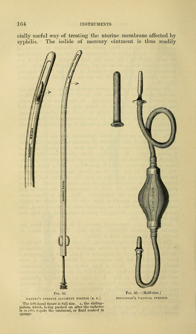 dally useful way of treating the uterine membrane affected by- syphilis. The iodide of mercury ointment is thus readily f-> m Fig. 52. BABNEs's UTERINE OINTMENT POSITOIt (b. B.). Tho left-hand figure is full size, a, the sliding- piston, which, being pushed on after the catheter is in eUd, expels the ointment, or fluid soaked in sponge. Fio. 53.—(Half-size.) iiigginson's vaginal syringe.