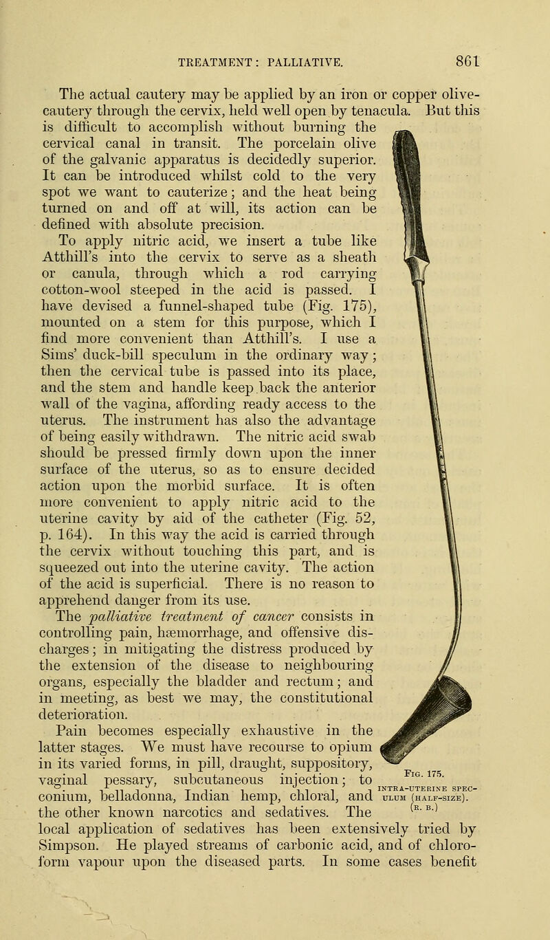 The actual cautery may be applied by an iron or copper olive- cautery through the cervix, held well open by tenacula. But this is difficult to accomplish without burning the cervical canal in transit. The porcelain olive of the galvanic apparatus is decidedly superior. It can be introduced whilst cold to the very spot we want to cauterize; and the heat being turned on and off at will, its action can be defined with absolute precision. To apply nitric acid, we insert a tube like Atthill's into the cervix to serve as a sheath or canula, through which a rod carrying cotton-wool steeped in the acid is passed. I have devised a funnel-shaped tube (Fig. 175), mounted on a stem for this purpose, which I find more convenient than Atthill's. I use a Sims' duck-bill speculum in the ordinary way; then the cervical tube is passed into its place, and the stem and handle keep back the anterior wall of the vagina, affording ready access to the uterus. The instrument has also the advantage of being easily withdrawn. The nitric acid swab should be pressed firmly down upon the inner surface of the uterus, so as to ensure decided action upon the morbid surface. It is often more convenient to apply nitric acid to the uterine cavity by aid of the catheter (Fig. 52, p. 164). In this way the acid is carried through the cervix without touching this part, and is stpieezed out into the uterine cavity. The action of the acid is superficial. There is no reason to apprehend danger from its use. The palliative treatment of cancer consists in controlling pain, haemorrhage, and offensive dis- charges ; in mitigating the distress produced by the extension of the disease to neighbouring- organs, especially the bladder and rectum; and in meeting, as best we may, the constitutional deterioration. Pain becomes especially exhaustive in the latter stages. We must have recourse to opium in its varied forms, in pill, draught, suppository, vaginal pessary, subcutaneous injection; to °. -i -n I T 1 • 1 IT 1 1 INTKA-UTERINE SPEC- conmm, belladonna, Indian hemp, chloral, and ulum (half-size). the other known narcotics and sedatives. The (R'B-) local application of sedatives has been extensively tried by Simpson. He played streams of carbonic acid, and of chloro- form vapour upon the diseased parts. In some cases benefit