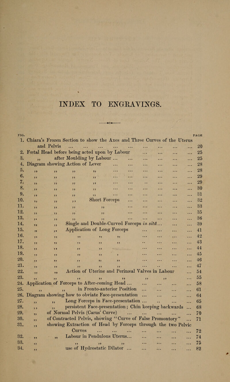 INDEX TO ENGEAYIIS^GS. FIG. 1. 2. 3. 4. 5. 6. 7. 8. 9. 10. 11. 12. 13. 14. 15. 16. 17. 18. 19. 20. 21. 22. 23. 24. 25. 26. 27. 28. 29. 30. 31. 32. 33. 34. Chiara's Frozen Section to show the Axes and Three Curves of the Uterus and Pelvis ... ... ... ... ... Foetal Head before being acted upon by Labour ,, after Moulding by Labour ... Diagram showing Action of Lever Short Forceps Single and Double-Curved Forceps in sitil. Application of Long Forceps ,, ,, Action of Uterine and Perinseal Valves in Labour 5> 5) 55 JJ »> J5 }J Application of Forceps to After-coming Head ... ,, „ in Fronto-anterior Position ... Diagram showing how to obviate Face-presentation ... ,, ,, Long Forceps in Face-presentation ... ,, „ persistent Face-presentation; Chin keeping backwards ... ,, of Normal Pelvis (Cams' Curve) ,, of Contracted Pelvis, showing Curve of False Promontory ,, showing Extraction of Head by Forceps through the two Pelvic Curves ,, ,, Labour in Pendulous Uterus 55 55 55 55 ,, use of Hydrostatic Dilator ... 20 25 25 28 28 29 29 30 31 32 33 35 36 39 41 42 43 44 45 46 47 54 55 58 61 64 65 68 70 71 72 74 75 82