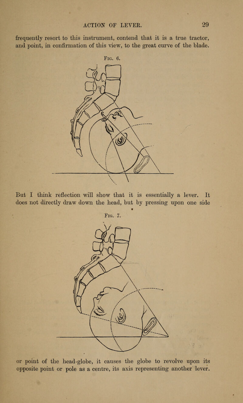 frequently resort to this instrument, contend that it is a true tractor, and point, in confirmation of this view, to the great curve of the blade. Fig. 6. But I think reflection will show that it is essentially a lever. It does not directly draw down the head, but by pressing upon one side Fig. 7. or point of the head-globe, it causes the globe to revolve upon its opposite point or pole as a centre, its axis representing another lever.