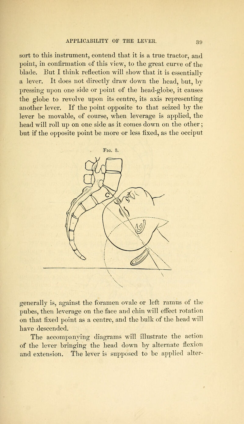 APPLICABILITY OF THE LEVER. sort to this instrument, contend that it is a true tractor, and point, in coniirmation of this view, to the great curve of the blade. But I think reflection will show that it is essentially a lever. It does not directly draw down the head, but, by pressing upon one side or point of the head-globe, it causes the globe to revolve upon its centre, its axis representing another lever. If the point opposite to that seized by the lever be movable, of course, when leverage is applied, the head will roll up on one side as it comes down on the other; but if the opposite point be more or less fixed, as the occiput Pig. 3. generally is, against the foramen ovale or left ramus of the pubes, then leverage on the face and chin will eifect rotation on that fixed point as a centre, and the bulk of the head will have descended. The accompanying diagrams will illustrate the action of the lever bringing the head down by alternate flexion and extension. The lever is supposed to be applied alter-