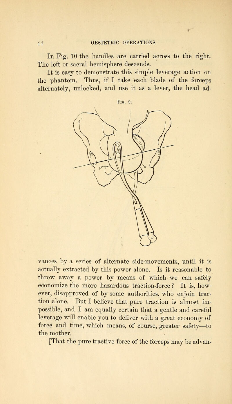 In Fig. 10 the handles are carried across to the right. The left or sacral hemisphere descends. It is easy to demonstrate this simple leverage action on the phantom. Thus, if I take each blade of the forceps alternately, unlocked, and use it as a lever, the head ad- FiG. 9. vances by a series of alternate side-movements, until it is actually extracted by this power alone. Is it reasonable to throw away a power by means of which we can safely economize the more hazardous traction-force ? It is, how- ever, disapproved of by some authorities, who enjoin trac- tion alone. But I believe that pure traction is almost im- possible, and I am equally certain that a gentle and careful leverage will enable you to deliver with a great economy of force and time, which means, of course, greater safety—to the mother. [That the pure tractive force of the forceps may be advan-