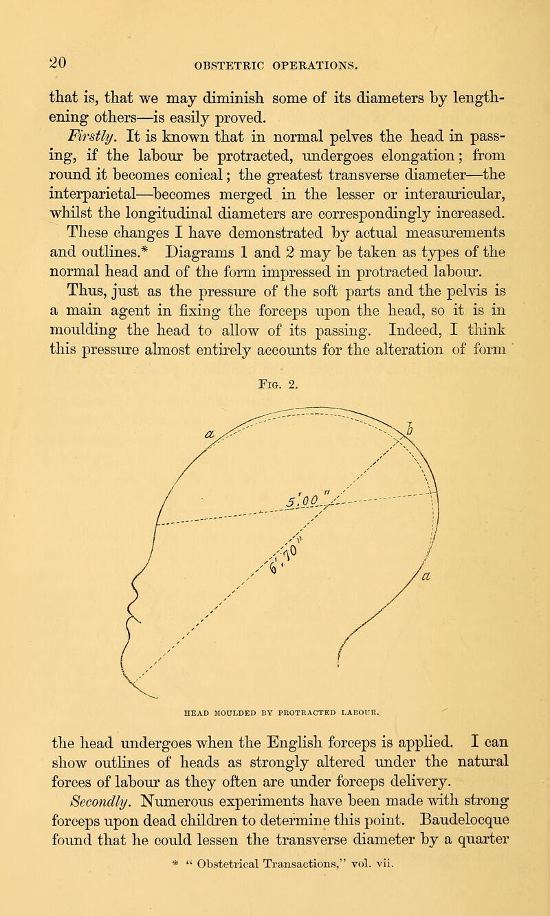 that is, that we may diminish some of its diameters by length- ening others—is easily proved. Firstly. It is known that in normal pelves the head in pass- ing, if the labour be protracted, undergoes elongation; from round it becomes conical; the greatest transverse diameter—the interparietal—^becomes merged in the lesser or interauricular, whilst the longitudinal diameters are correspondingly increased. These changes I have demonstrated by actual measurements and outlines.* Diagrams 1 and 2 may be taken as types of the normal head and of the form impressed in protracted labour. Thus, just as the pressure of the soft parts and the pelvis is a main agent in fixing the forceps u]oon the head, so it is in moulding the head to allow of its passing. Indeed, I think this pressure almost entirely accounts for the alteration of form Fig. 2. HEAD MOULDED BY PROTRACTED LABOUR. the head undergoes when the English forceps is applied. I can show outhnes of heads as strongly altered under the natural forces of labom* as they often are under forceps delivery, Secondly. Numerous experiments have been made with strong forceps upon dead children to determine this point. Baudelocque found that he could lessen the transverse diameter by a quarter *  Obstetrical Transactions, vol. vii.