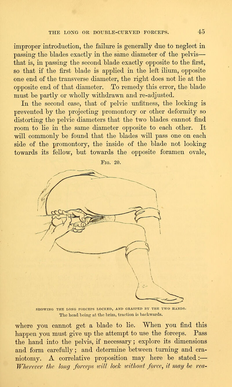 improper introduction, the failure is generally due to neglect in passing the blades exactly in the same diameter of the pelvis— that is, in passing the second blade exactly opposite to the first, so that if the first blade is applied in the left ilium, opposite one end of the transverse diameter, the right does not lie at the opposite end of that diameter. To remedy this error, the blade must be partly or wholly withdrawn and re-adjusted. In the second case, that of pelvic unfitness, the locking is prevented by the projecting promontory or other deformity so distorting the pelvic diameters that the two blades cannot find room to lie in the same diameter opposite to each other. It will commonly be found that the blades will pass one on each side of the promontory, the inside of the blade not looking towards its fellow, but towards the opposite foramen ovale, Fig. 20. SHOWING THE LONG FOP.CEPS LOCKED, AND GRASPED BY THE TWO HANDS. The head heing at the brim, traction is backwards. where you cannot get a blade to lie. When you find this happen you must give up the attempt to use the forceps. Pass the hand into the pelvis, if necessary; explore its dimensions and form carefully; and determine between turning and cra- niotomy. A correlative proposition may here be stated:— Wherever the long forceps will lode without force, it may he rea-