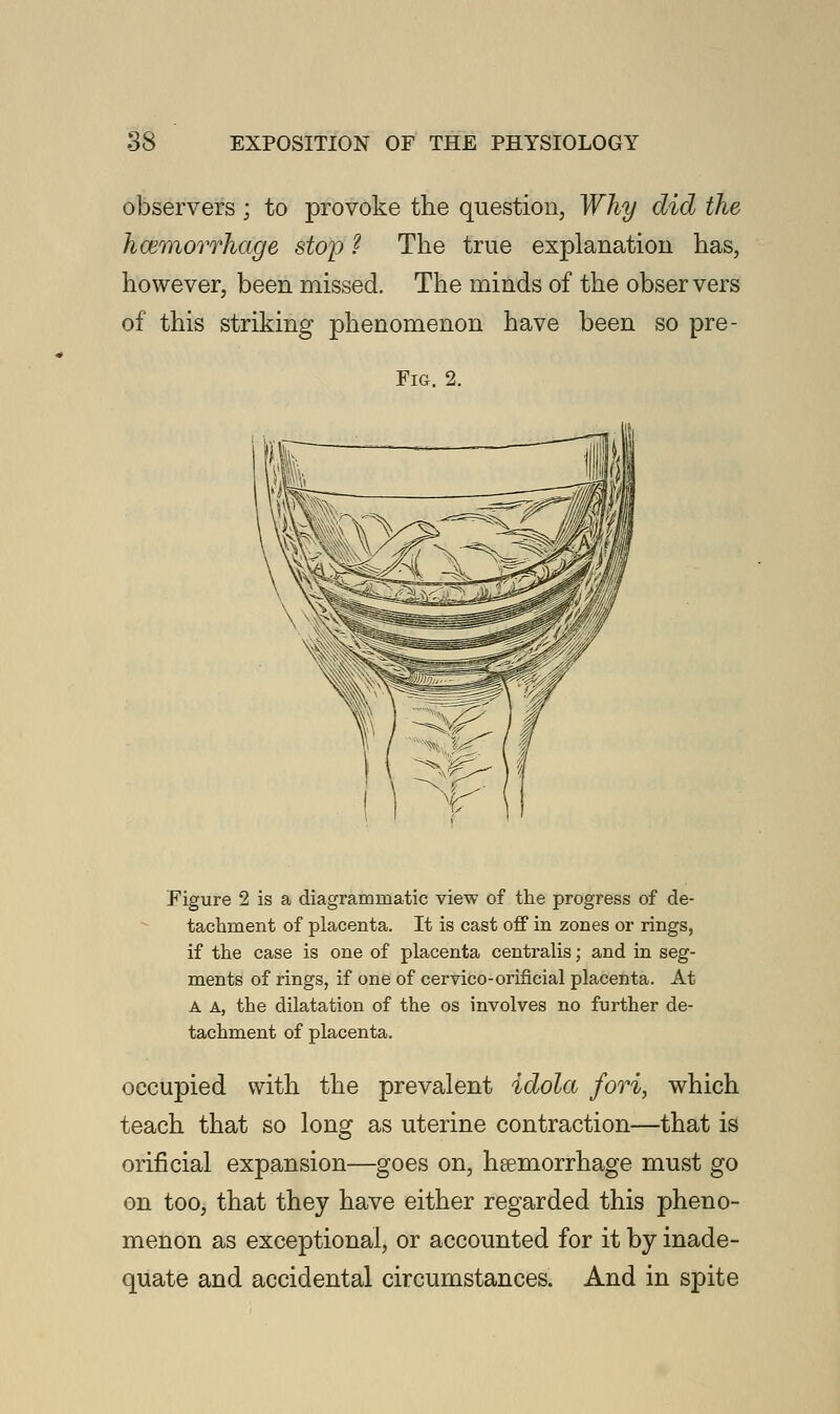 observers ; to provoke the question, Why did the hcemorrhage stop ? The true explanation has, however, been missed. The minds of the observers of this striking phenomenon have been so pre- Fig. 2. Figure 2 is a diagrammatic view of the progress of de- tachment of placenta. It is cast off in zones or rings, if the case is one of placenta centralis; and in seg- ments of rings, if one of cervico-orificial placenta. At A A, the dilatation of the os involves no further de- tachment of placenta. occupied with the prevalent idola fori, which teach that so long as uterine contraction—that is orificial expansion—goes on, hemorrhage must go on too, that they have either regarded this pheno- menon as exceptional, or accounted for it by inade- quate and accidental circumstances. And in spite