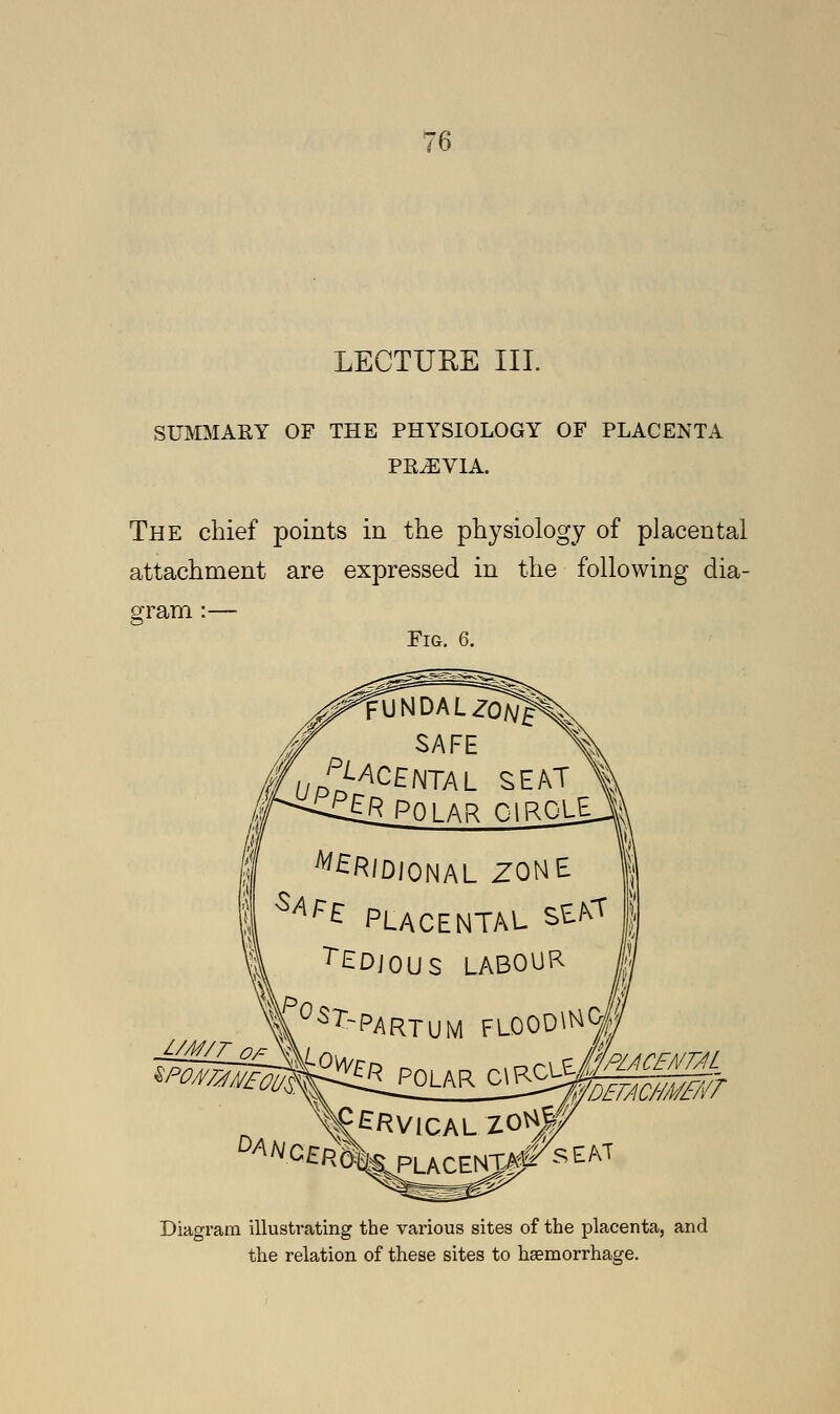 LECTURE III. SUMMARY OF THE PHYSIOLOGY OF PLACENTA PREVIA. The chief points in the physiology of placental attachment are expressed in the following dia- gram :— Fig. 6. fUNDALZo/Jf pLACE SAFE NTAL SEAT POLAR CIRCLE 'DIONAL ZOHt 1 Uf* PLACENTAL Sfctf | r£DJ0US LABOUR ¥°S^PARTUM FL00D1HW Diagram illustrating the various sites of the placenta, and the relation of these sites to haemorrhage.