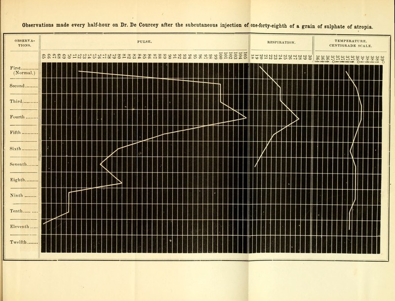 OBSERVA- TIONS. First (Normal. Second Third. Fourth Fifth Sixth. O) O: 5! O! « -1 »J ^ CJ -1 QD to O H I I Seventh _| Eighth. Ninth Tenth. Twelfth. II II RESPIRATION. TEMPERATURE. CENTIGRADE SCALE.