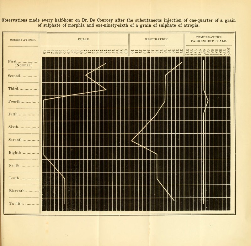 Observations made every half-hour on Dr. De Courcey after the subcutaneous injection of one-quarter of a grain of sulphate of morphia and one-ninety-sixth of a grain of sulphate of atropia. OBSERVATIONS. TULSE. t> „<,,>„> . ™™ TEMPERATURE. RESPIRATION. FAHRENHEIT SCALE. First » O) o> O) O) O) Ol Cl n m -1 -T -I -J -1 -J -J -T ^1 »1 00 OHMw^O'O-iQoooewM^wos-jooao O i—• to CO >t* V © -J 00 ID © 1—' to -J -1 -1 -I 00 00 oc or. <x <o © ■■I IIHIMil mi minim iii mil n (Normal.) mill IIK5MI iimiiri ill I ill ii It! 291 Third mi iiiiiiii i in iiii ii Fourth riii III 1 1 Ill III II mm im Fifth ii Sixth III 1 III ii in i in ii llll HI ii in i m ii Eighth III 1 HI ■ mi a Ninth IB 1 ■ in n in i m ii 11 III II mi 1 n ii in i m ii Eleventh III II II 1 um in i m ii