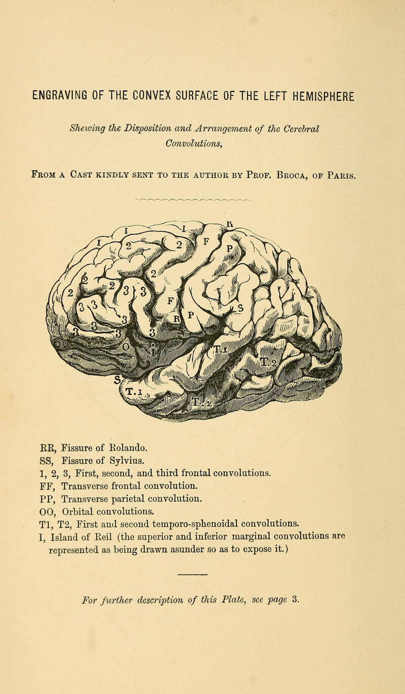 ENGRAVING OF THE CONVEX SURFACE OF THE LEFT HEMISPHERE Shemng the Disposition and Arrangement of the Cerebral Convolutions, Feom a Cast kindly sent to the authok by Prof. Broca, of Paris. RR, Fissure of Rolando. SS, Fissure of Sylvius. 1, 2, 3, First, second, and third frontal convolutions. FF, Transverse frontal convolution. PP, Transverse parietal convolution. 00, Orbital convolutions. Tl, T2, First and second temporo-sphenoidal convolutions. 1, Island of Reil (the superior and inferior marginal convolutions are represented as being drawn asunder so as to expose it.) For further description of this Plate, see page 3.
