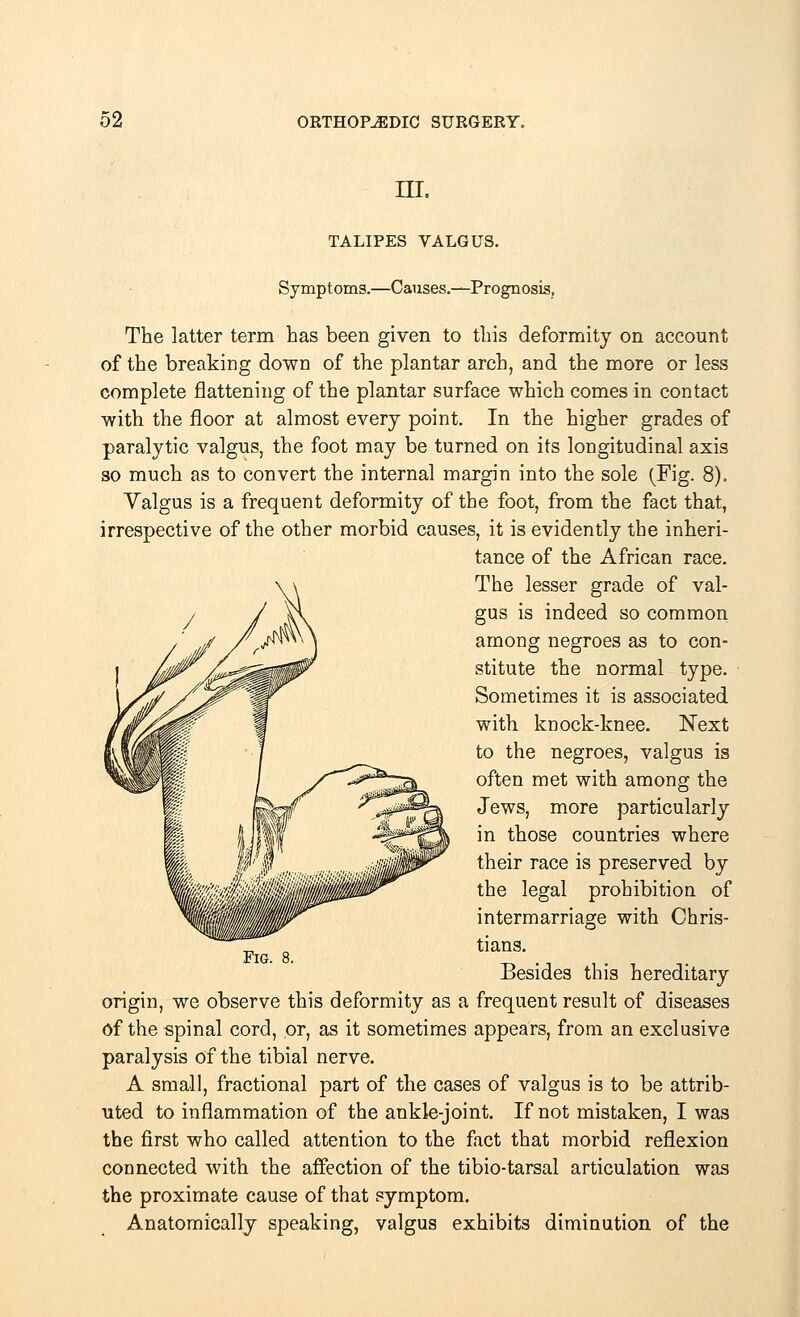 ni. TALIPES VALGUS. Symptoms.—Causes.—Prognosis, The latter term has been given to this deformity on account of the breaking down of the plantar arch, and the more or less complete flattening of the plantar surface which comes in contact with the floor at almost every point. In the higher grades of paralytic valgus, the foot may be turned on its longitudinal axis so much as to convert the internal margin into the sole (Fig. 8). Valgus is a frequent deformity of the foot, from the fact that, irrespective of the other morbid causes, it is evidently the inheri- tance of the African race. The lesser grade of val- gus is indeed so common among negroes as to con- stitute the normal type. Sometimes it is associated with knock-knee. Next to the negroes, valgus is often met with among the Jews, more particularly in those countries where their race is preserved by the legal prohibition of intermarriage with Chris- tians. Besides this hereditary origin, we observe this deformity as a frequent result of diseases Of the spinal cord, or, as it sometimes appears, from an exclusive paralysis of the tibial nerve. A small, fractional part of the cases of valgus is to be attrib- uted to inflammation of the ankle-joint. If not mistaken, I was the first who called attention to the fact that morbid reflexion connected with the affection of the tibio-tarsal articulation was the proximate cause of that symptom. Anatomically speaking, valgus exhibits diminution of the Fig. 8.