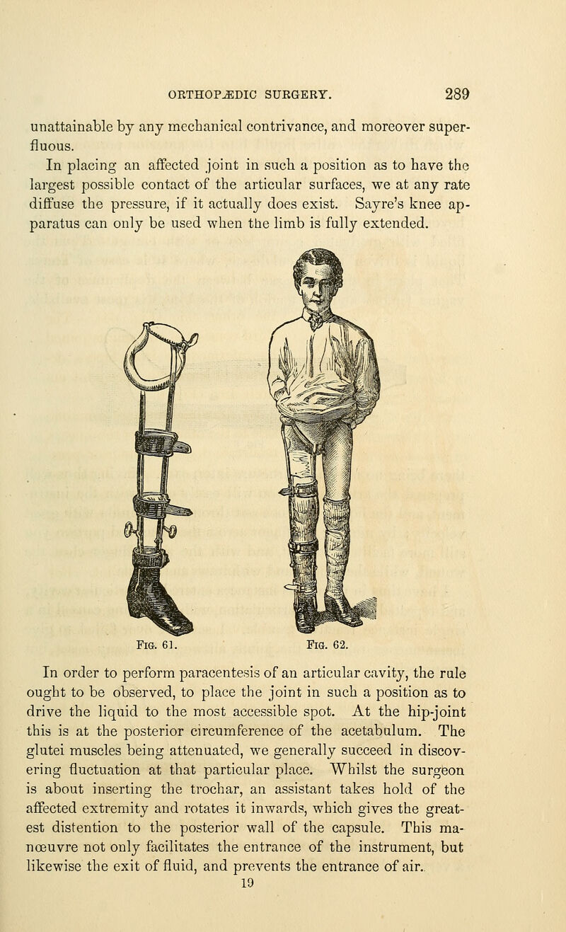 unattainable by any mechanical contrivance, and moreover super- fluous. In placing an affected joint in such a position as to have the largest possible contact of the articular surfaces, we at any rate diffuse the pressure, if it actually does exist. Sayre's knee ap- paratus can only be used when the limb is fully extended. Fig. 61. Fig. 62. In order to perform paracentesis of an articular cavity, the rale ought to be observed, to place the joint in such a position as to drive the liquid to the most accessible spot. At the hip-joint this is at the posterior circumference of the acetabulum. The glutei muscles being attenuated, we generally succeed in discov- ering fluctuation at that particular place. Whilst the surgeon is about inserting the trochar, an assistant takes hold of the affected extremity and rotates it inwards, which gives the great- est distention to the posterior wall of the capsule. This ma- noeuvre not only facilitates the entrance of the instrument, but likewise the exit of fluid, and prevents the entrance of air.. 19