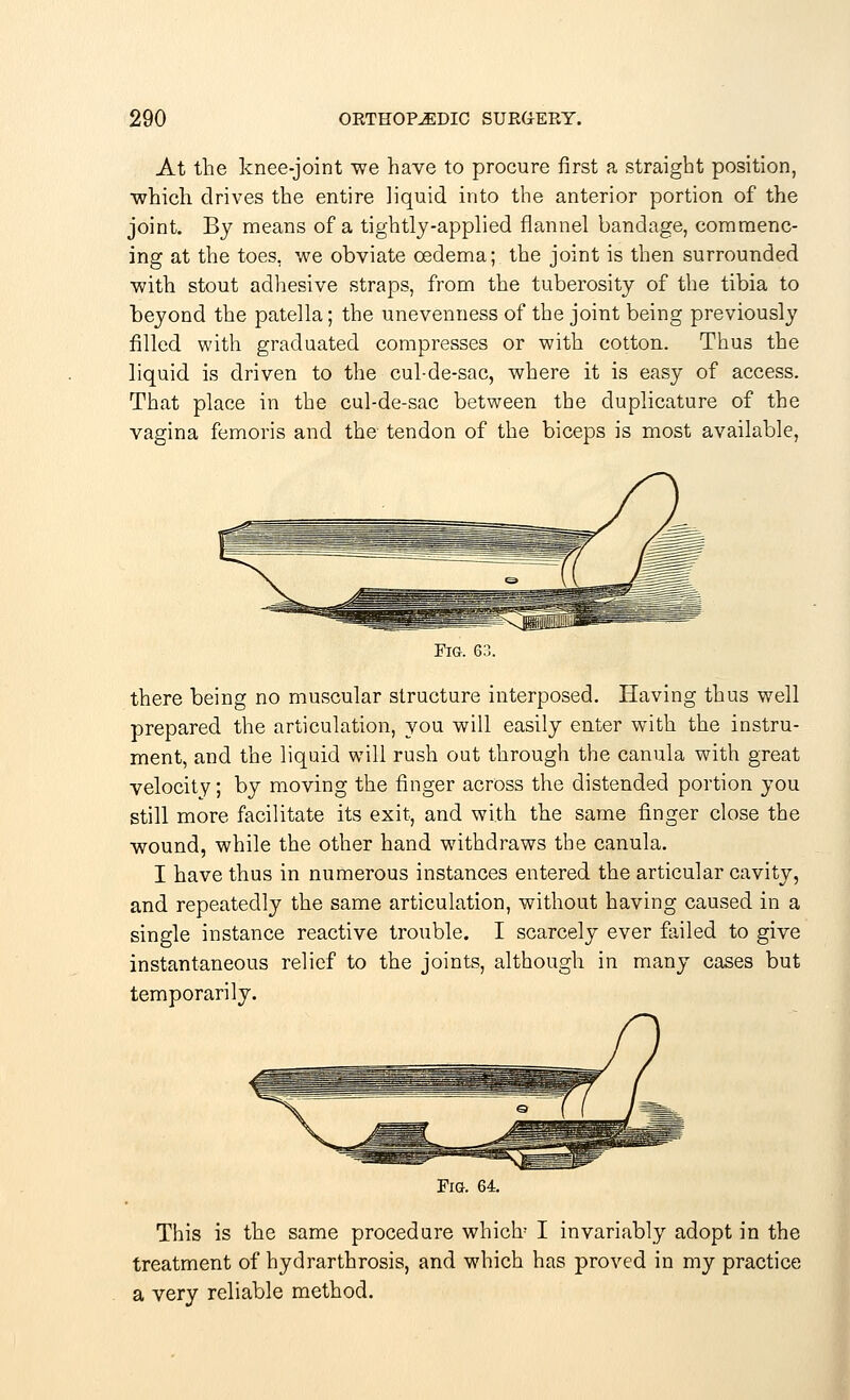 At the knee-joint we have to procure first a straight position, which drives the entire liquid into the anterior portion of the joint. By means of a tightly-applied flannel bandage, commenc- ing at the toes, we obviate oedema; the joint is then surrounded with stout adhesive straps, from the tuberosity of the tibia to beyond the patella; the unevenness of the joint being previously filled with graduated compresses or with cotton. Thus the liquid is driven to the cul-de-sac, where it is easy of access. That place in the cul-de-sac between the duplicative of the vagina femoris and the tendon of the biceps is most available, Fig. 63. there being no muscular structure interposed. Having thus well prepared the articulation, you will easily enter with the instru- ment, and the liquid will rush out through the canula with great velocity; by moving the finger across the distended portion you still more facilitate its exit, and with the same finger close the wound, while the other hand withdraws the canula. I have thus in numerous instances entered the articular cavity, and repeatedly the same articulation, without having caused in a single instance reactive trouble. I scarcely ever failed to give instantaneous relief to the joints, although in many cases but temporarily. Fig. 64. This is the same procedure which1 I invariably adopt in the treatment of hydrarthrosis, and which has proved in my practice a very reliable method.