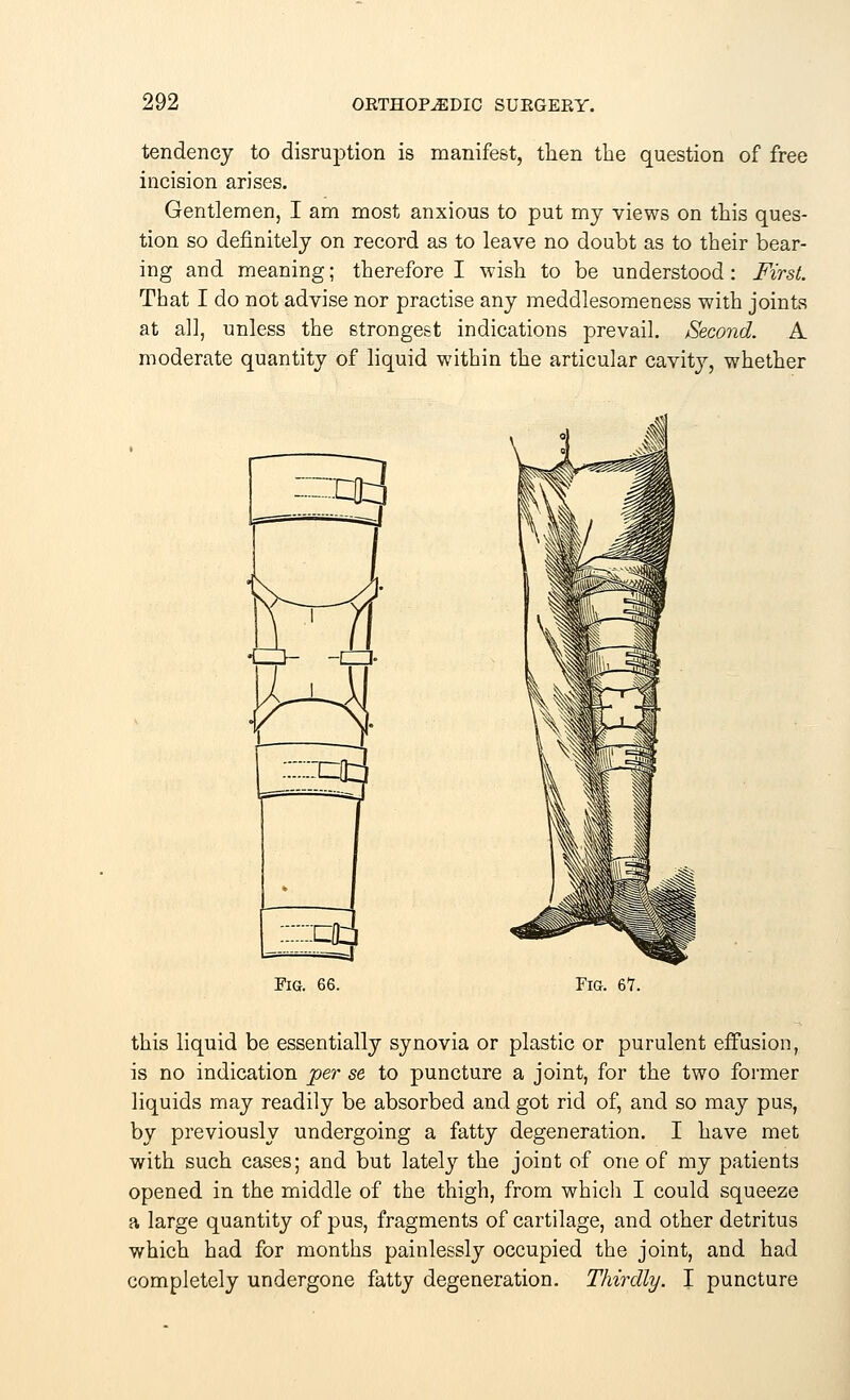 tendency to disruption is manifest, then the question of free incision arises. Gentlemen, I am most anxious to put my views on this ques- tion so definitely on record as to leave no doubt as to their bear- ing and meaning; therefore I wish to be understood: First. That I do not advise nor practise any meddlesomeness with joints at all, unless the strongest indications prevail. Second. A moderate quantity of liquid within the articular cavity, whether Fig. 67. this liquid be essentially synovia or plastic or purulent effusion, is no indication per se to puncture a joint, for the two former liquids may readily be absorbed and got rid of, and so may pus, by previously undergoing a fatty degeneration. I have met with such cases; and but lately the joint of one of my patients opened in the middle of the thigh, from which I could squeeze a large quantity of pus, fragments of cartilage, and other detritus which had for months painlessly occupied the joint, and had completely undergone fatty degeneration. Thirdly. I puncture