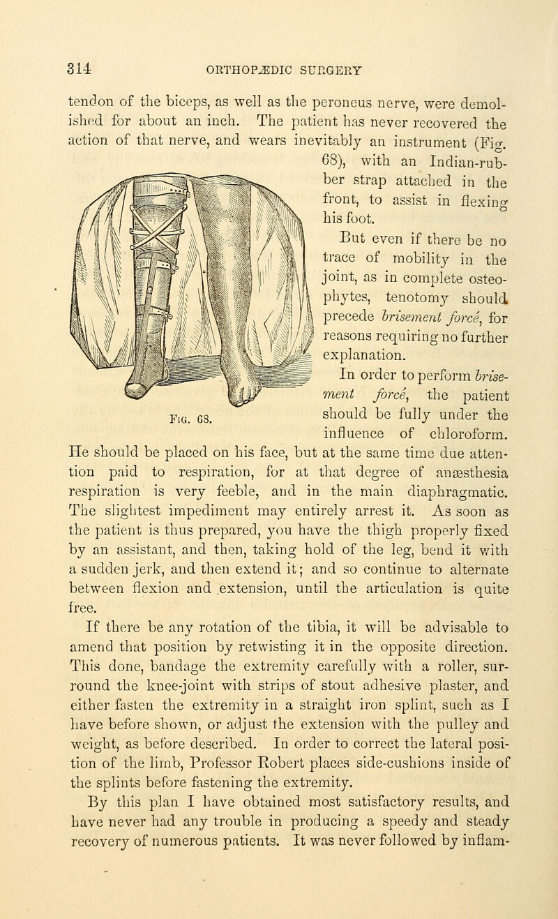 tendon of the biceps, as well as the peroneus nerve, were demol- ished for about an inch. The patient has never recovered the action of that nerve, and wears inevitably an instrument (Fi°-. 68), with an Indian-rub- ber strap attached in the front, to assist in flexing his foot. But even if there be no trace of mobility in the joint, as in complete osteo- phytes, tenotomy should precede brisement force, for reasons requiring no further explanation. In order to perform brise- ment force, the patient should be fully under the influence of chloroform. He should be placed on his face, but at the same time due atten- tion paid to respiration, for at that degree of anaesthesia respiration is very feeble, and in the main diaphragmatic. The slightest impediment may entirely arrest it. As soon as the patient is thus prepared, you have the thigh properly fixed by an assistant, and then, taking hold of the leg, bend it with a sudden jerk, and then extend it; and so continue to alternate between flexion and extension, until the articulation is quite free. If there be any rotation of the tibia, it will be advisable to amend that position by retwisting it in the opposite direction. This done, bandage the extremity carefully with a roller, sur- round the knee-joint with strips of stout adhesive plaster, and either fasten the extremity in a straight iron splint, such as I have before shown, or adjust the extension with the pulley and weight, as before described. In order to correct the lateral posi- tion of the limb, Professor Robert places side-cushions inside of the splints before fastening the extremity. By this plan I have obtained most satisfactory results, and have never had any trouble in producing a speedy and steady recovery of numerous patients. It was never followed by inflam-