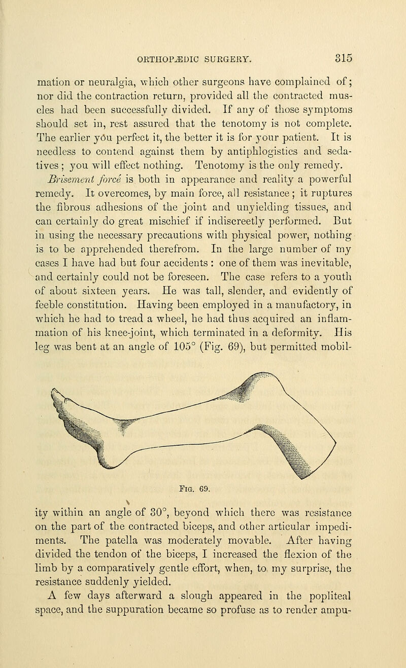 mation or neuralgia, which other surgeons have complained of; nor did the contraction return, provided all the contracted mus- cles had been successfully divided. If any of those symptoms should set in, rest assured that the tenotomy is not complete. The earlier yOu perfect it, the better it is for your patient. It is needless to contend against them by antiphlogistics and seda- tives ; you will effect nothing. Tenotomy is the only remedy. Brisement force is both in appearance and reality a powerful remedy. It overcomes, by main force, all resistance ; it ruptures the fibrous adhesions of the joint and unyielding tissues, and can certainly do great mischief if indiscreetly performed. But in using the necessary precautions with physical power, nothing is to be apprehended therefrom. In the large number of my cases I have had but four accidents : one of them was inevitable, and certainly could not be foreseen. The case refers to a youth of about sixteen years. He was tall, slender, and evidently of feeble constitution. Having been employed in a manufactory, in which he had to tread a wheel, he had thus acquired an inflam- mation of his knee-joint, which terminated in a deformity. His leg was bent at an angle of 105° (Fig. 69), but permitted mobil- ity within an angle of 30°, beyond which there was resistance on the part of the contracted biceps, and other articular impedi- ments. The patella was moderately movable. After having divided the tendon of the biceps, I increased the flexion of the limb by a comparatively gentle effort, when, to my surprise, the resistance suddenly yielded. A few days afterward a slough appeared in the popliteal space, and the suppuration became so profuse as to render ampu-