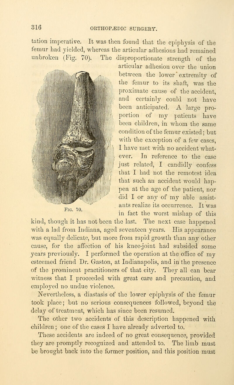 tation imperative. It was then found that the epiphysis of the femur had yielded, whereas the articular adhesions had remained unbroken (Fig. 70). The disproportionate strength of the articular adhesion over the union between the lower' extremity of the femur to its shaft, was the proximate cause of the accident, and certainly could not have been anticipated. A large pro- portion of my patients have been children, in whom the same condition of the femur existed; but with the exception of a few cases, I have met with no accident what- ever. In reference to the case just related, I candidly confess that I had not the remotest idea that such an accident would hap- pen at the age of the patient, nor did I or any of my able assist- ants realize its occurrence. It was in fact the worst mishap of this kind, though it has not been the last. The next case happened with a lad from Indiana, aged seventeen years. His appearance was equally delicate, but more from rapid growth than any other cause, for the affection of his knee-joint had subsided some years previously. I performed the operation at the office of my esteemed friend Dr. Gaston, at Indianapolis, and in the presence of the prominent practitioners of that city. They all can bear witness that I proceeded with great care and precaution, and employed no undue violence. Nevertheless, a diastasis of the lower epiphysis of the femur took place; but no serious consequences followed, beyond the delay of treatment, which has since been resumed. The other two accidents of this description happened with children ; one of the cases I have already adverted to. These accidents are indeed of no great consequence, provided they are promptly recognized and attended to. The limb must be brought back into the former position, and this position must