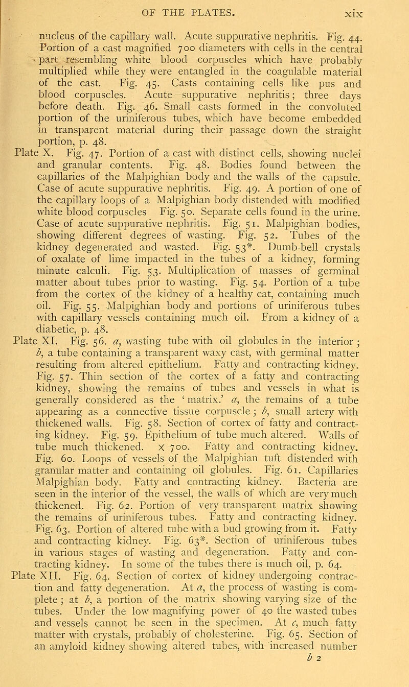 nucleus of the capillary wall. Acute suppurative nephritis. Fig. 44. Portion of a cast magnified 700 diameters with cells in the central • part resembling v/hite blood corpuscles which have probably multiplied while they were entangled in the coagulable material of the cast. Fig. 45. Casts containing cells like pus and blood corpuscles. Acute suppurative nephritis; three days before death. Fig. 46. Small casts formed in the convoluted portion of the uriniferous tubes, which have become embedded in transparent material during their passage down the straight portion, p. 48. Plate X. Fig. 47. Portion of a cast with distinct cells, showing nuclei and granular contents. Fig. 48. Bodies found between the capillaries of the Malpighian body and the walls of the capsule. Case of acute suppurative nephritis. Fig. 49. A portion of one of the capillary loops of a Malpighian body distended with modified white blood corpuscles Fig. 50. Separate cells found in the urine. Case of acute suppurative nephritis. Fig. 51. Malpighian bodies, showing different degrees of wasting. Fig. 52. Tubes of the kidney degenerated and wasted. Fig. 53*. Dumb-bell crystals of oxalate of lime impacted in the tubes of a kidney, forming minute calculi. Fig. 53. Multiplication of masses of germinal matter about tubes prior to wasting. Fig. 54. Portion of a tube from the cortex of the kidney of a healthy cat, contaming much oil. Fig. 55. -Malpighian body and portions of uriniferous tubes with capillary vessels containing much oil. From a kidney of a diabetic, p. 48. Plate XL Fig. 56. (1;, wasting tube Avith oil globules in the interior; b^ a tube containing a transparent waxy cast, with germinal matter resulting from altered epithelium. Fatty and contracting kidney. Fig. 57. Thin section of the cortex of a fatty and contracting kidney, showing the remains of tubes and vessels in what is generally considered as the ' matrix.' a, the remains of a tube appearing as a connective tissue corpuscle ; b, small artery with thickened walls. Fig. 58. Section of cortex of fatty and contract- ing kidney. Fig. 59. Epithelium of tube much altered. Walls of tube much thickened. X 700. Fatty and contracting kidney. Fig. 60. Loops of vessels of the Malpighian tuft distended with granular matter and containing oil globules. Fig. 61. Capillaries Malpighian body. Fatty and contracting kidney. Bacteria are seen in the interior of the vessel, the walls of which are very much thickened. Fig. 62. Portion of very transparent matrix showing the remains of uriniferous tubes. Fatty and contracting kidney. Fig. 63. Portion of altered tube with a bud growing from it. Fatty and contracting kidney. Fig. 63*. Section of uriniferous tubes in various stages of wasting and degeneration. Fatty and con- tracting kidney. In some of the tubes there is much oil, p. 64. Plate XII. Fig. 64. Section of cortex of kidney undergoing contrac- tion and fatty degeneration. At a, the process of wasting is com- plete ; at b, di portion of the ma^trix showing varying size of the tubes. Under the low magnifying power of 40 the wasted tubes and vessels cannot be seen in the specimen. At c, much fatty matter with crystals, probably of cholesterine. Fig. 65. Section of an amyloid kidney showing altered tubes, with increased number b 2