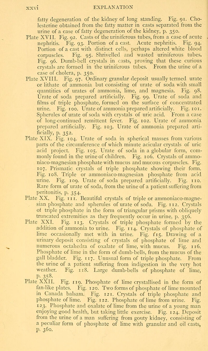 fatty degeneration of the kidney of long standing. Fig. 91. Cho- lesterine obtained from the fatty matter in casts separated from the urine of a case of fatty degeneration of the kidney, p. 350. Plate XVII. Fig. 92. Casts of the uriniferous tubes, from a case of acute nephritis. Fig. 93. Portion of a cast. Acute nephritis. Fig. 94. Portion of a cast with distinct cells, perhaps altered white blood corpuscles. Fig. 95. Shrivelled and wasted uriniferous tubes. Fig. 96. Dumb-bell crystals in casts, proving that these curious crystals are formed in the uriniferous tubes. From the urine of a case of cholera, p. 350. Plate XVIII. Fig. 97. Ordinary granular deposit usually termed virate or lithate of ammonia but consisting of urate of soda with small quantities of urates of ammonia, lime, and magnesia. Fig. 98, Urate of soda prepared artificially. Fig. 99. Urate of soda and films of triple phosphate, formed on the surface of concentrated urine. Fig. 100. Urate of ammonia prepared artificially. Fig. 101. Spherules of urate of soda with crystals of uric acid. From a case of long-continued remittent fever. Fig. 102. Urate of ammonia prepared artificially. Fig. 103. Urate of ammonia prepared arti- ficially, p. 352. Plate XIX. Fig. 104. Urate of soda in spherical masses from various parts of the circumference of which minute acicular crystals of uric acid project. Fig. 105. Urate of soda in a globular form, com- monly found in the urine of children. Fig. 106. Crystals of ammo- niaco-magnesian phosphate with mucus and mucous corpuscles. Fig. 107. Prismatic crystals of triple phosphate showing their form. Fig. 108. Triple or ammoniaco-magnesian phosphate from acid urine. Fig. 109. Urate of soda prepared artificially. Fig. no. Rare form of urate of soda, from the urine of a patient suffering from peritonitis, p. 354. Plate XX. Fig. tii. Beautiful crystals of triple or ammoniaco-magne- sian phosphate and spherules of urate of soda. Fig. 112. Crystals of triple phosphate in the form of triangular prisms with obliquely truncated extremities as they frequently occur in urine, p. 356. Plate XXI. Fig. 113. Crystals of triple phosphate formed by the addition of ammonia to urine. Fig. 114. Crystals of phosphate of lime occasionally met with in urine. Fig. 115. Drawing of a urinary deposit consisting of crystals of phosphate of lime and numerous octahedra of oxalate of lime, with mucus. Fig. 116. Phosphate of lime in the form of dumb-bells, from the mucus of the gall bladder. Fig. T17. Unusual form of triple phosphate. From the urine of a patient suffering from indigestion in the very hot weather. Fig. 118. Large dumb-bells of phosphate of lime, P- 358- Plate XXII. Fig. 119. Phosphate of lime crystallised in the form of fan-like plates. Fig. 120. Two forms of phosphate of lime mounted in Canada balsam. Fig. 121. Crystals of triple phosphate and phosphate of hme. Fig. 122. Phosphate of lime from urine. Fig. 123. Phosphate and oxalate of lime from the urine of a young man enjoying good health, but taking little exercise. Fig. 124. Deposit from the urine of a man suffering from gouty kidney, consisting of a peculiar form of phosphate of lime with granular and oil casts, p. 360.