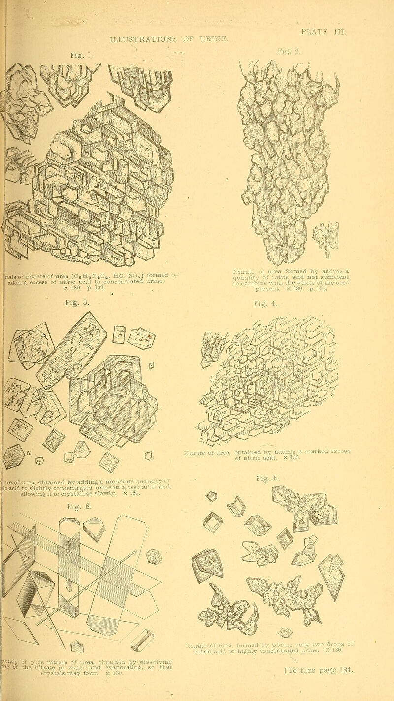 PLATK Jll. Fi^ 1 [itals of nitrate of urea (CaH^NaOj, HO, NO5) torme( adding excess of nitric acid to concentrated urine- X 130. p 133. ,. ^. P-1 W&iW '^i Mitratc oi urea formed by addinj^ a ijuauticy ot nitric acid not suiEeient to (.■oinbine wnii tbe whole of tlie urea preoeut. X 130. p. 132. Fl^. 4. Nitrate of-urea obtained by addmi* a marked . of nitric acid. X 130. fi «e ot uiea, obtained by adding a moder.aie quantity of tic acid to slightly concentrated urine in a,, test tube. auP-. 1 allowing It to crystallize slowly, x 130. Fig. 6. ?staia ot puie niti-riLe oi bLcLiaed by clibboU ne of Uie nitiate la '^atrr and evapotatiu^ so ibat ■^tals may foim x l^n