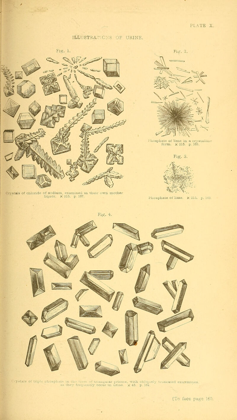 IL1USTRA1'1C:\S OF URINE. Crystals of cJaloride of sodium, esarained m tbeir o-wrn raotber liquor. X 215. p, 167. L'hosphate of lime in a crybt-allu form. X 215. p. 163. Piiosphate of lime. X 215. p. Itj3. Fi£<. 4. iystals of triple rOaospb^ite m ih-. iumu of triautju.ar prisms, witla obhquelj' truncated exiremitie as they frequently occur in tarine. x 45. p. 16i.