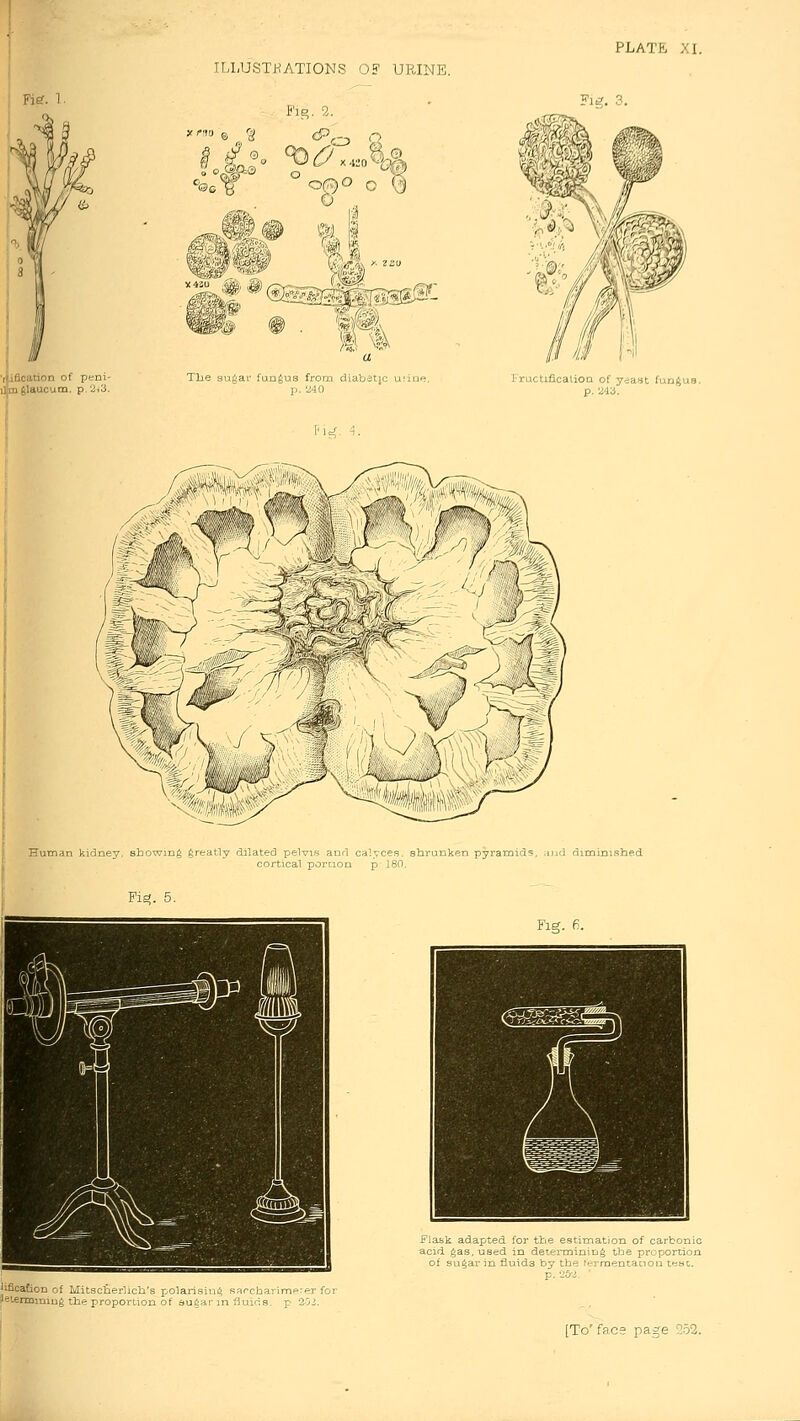 Fig. 1. 'Aification of peni- lAiiglaucum. p,'i<3. ! ILLUSTRATIONS OF URINE, fig. 2. 0 J ^r Tbe su^av fundus from diaVjetic unae p. 240 ,c<, 4. Jructificalion of yeast fungus, p. 24a. Human kidney, showing greatly dilated pelvis and calyces, shrunken pyranDids. .mri dmninisbed cortical portion p 180. Fii?. 5 lification of Mitsciierlicb's polari.sinii Barcharimp-er i ■eienniniug the proportion of sugar m fluiris. p 2'ji. Fig. 6. Flask adapted for the estimation of carbonic acid gas, used in determining tbe proportion of su^ar in fluids by tbe termentauou tt^at. p. 262.