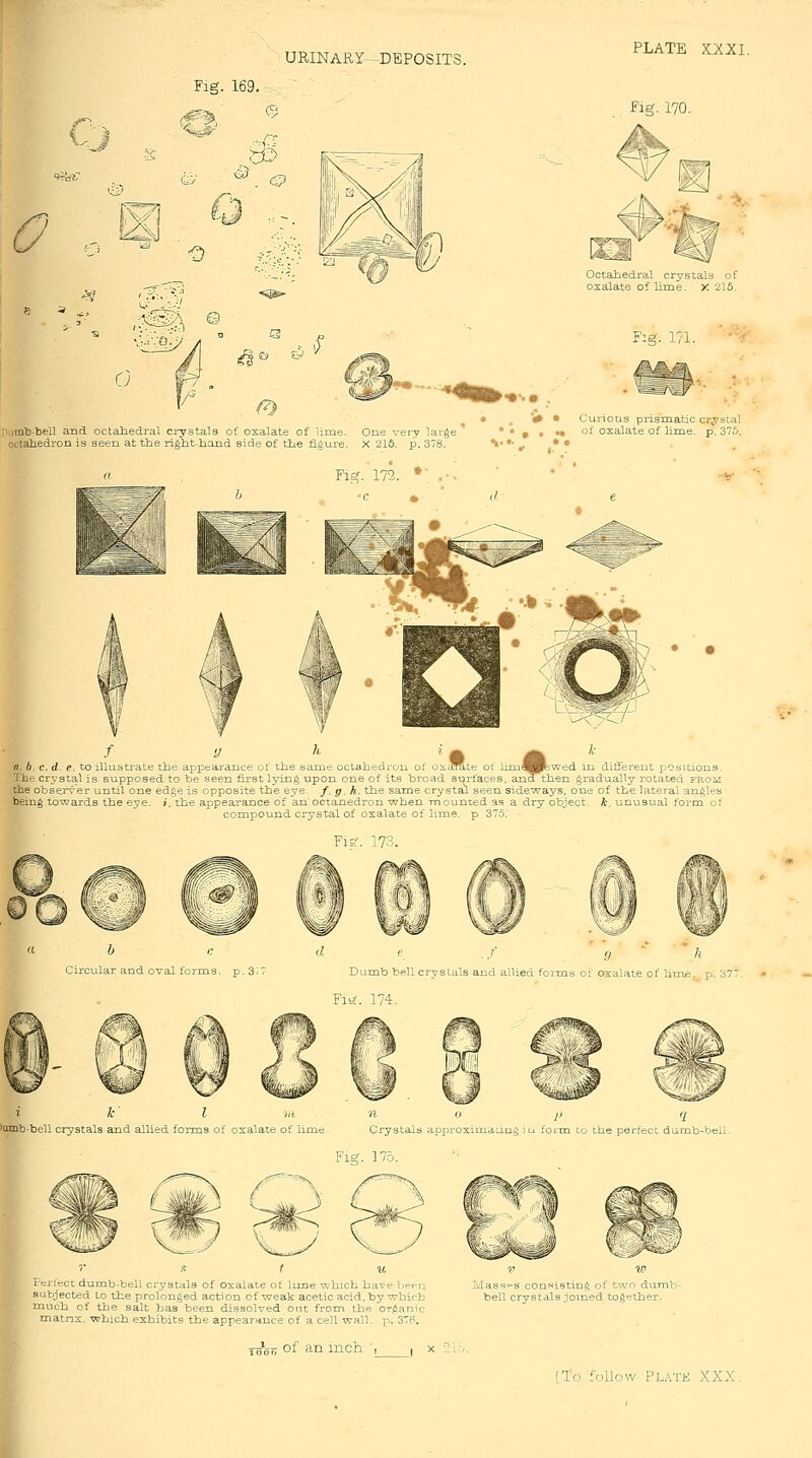 Fig. 169. 1. ^ (5 s PLATE XXXI. Pig. 170. i ® .,J 0 Mmb-bell and octaliedral crystals of oxalate of Ume. One very large octahedron is seen at the right-hand side of the figure. X 216. p. 378. Fig. 171. m • Curious prismatic crystal ^ « •• of oxalate of lime. p. 375. ' ^Lte o: liniH^v surfaces, andthf a. b. c. d. e. to illustrate the appearance of the same octahedi'on of oxaffcLte of limM^wed in different ij'^sitions. 'i'be crystal is supposed to be seen first lyixig upon one of its broad surfaces, and then gradually rotated from the obsejTer until one edge is opposite the eye. f.g.h. the same crystal seen sideways, one of the lateral angles being towards the eye. i. the appearance of an octanedron -when mounted as a dry object, k. unusual form of compound crystal of oxalate of lime, p 375; ■ Fi2 7 jlar and oval forms, p. 3 ■ f 9 h Dumb bell cryslals and allied foixQs of osalate of lime, p: 377 Fii?. 174. i'ericct dumb-bell crystals of oxalate of lime which have befii .subjected to the prolonged action of weak acetic acid, by which much of the salt has been dissolved out from the organic matns. -which exhibits the appearance of a cell wall. -p. 37P. YTj'gf; of an inch '^ , > Masss'S consisting of two dumb- bell crystals joined together.