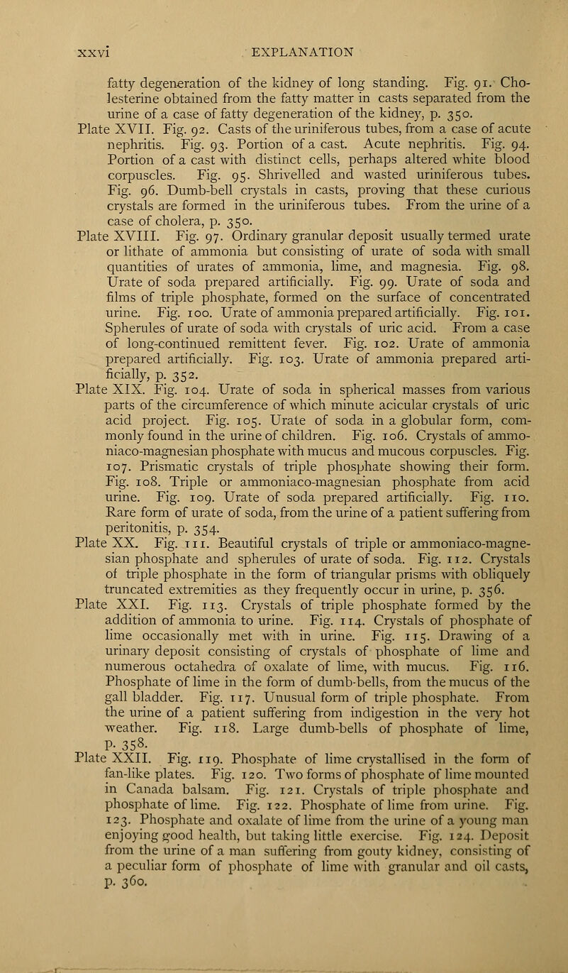 fatty degeneration of the kidney of long standing. Fig. 91. Cho- lesterine obtained from the fatty matter in casts separated from the urine of a case of fatty degeneration of the kidney, p. 350. Plate XVII. Fig. 92. Casts of the uriniferous tubes, from a case of acute nephritis. Fig. 93. Portion of a cast. Acute nephritis. Fig. 94. Portion of a cast with distinct cells, perhaps altered white blood corpuscles. Fig. 95. Shrivelled and wasted uriniferous tubes. Fig. 96. Dumb-bell crystals in casts, proving that these curious crystals are formed in the uriniferous tubes. From the urine of a case of cholera, p. 350. Plate XVIII. Fig. 97. Ordinary granular deposit usually termed urate or lithate of ammonia but consisting of urate of soda with small quantities of urates of ammonia, lime, and magnesia. Fig. 98. Urate of soda prepared artificially. Fig. 99. Urate of soda and films of triple phosphate, formed on the surface of concentrated urine. Fig. 100. Urate of ammonia prepared artificially. Fig. 101. Spherules of urate of soda with crystals of uric acid. From a case of long-continued remittent fever. Fig. 102. Urate of ammonia prepared artificially. Fig. 103. Urate of ammonia prepared arti- ficially, p. 352. Plate XIX. Fig. 104. Urate of soda in spherical masses from various parts of the circumference of which minute acicular crystals of uric acid project. Fig. 105. Urate of soda in a globular form, com- monly found in the urine of children. Fig. 106. Crystals of ammo- niaco-magnesian phosphate with mucus and mucous corpuscles. Fig. 107. Prismatic crystals of triple phosphate showing their form. Fig. 108. Triple or ammoniaco-magnesian phosphate from acid urine. Fig. 109. Urate of soda prepared artificially. Fig. no. Rare form of urate of soda, from the urine of a patient suffering from peritonitis, p. 354. Plate XX. Fig. in. Beautiful crystals of triple or ammoniaco-magne- sian phosphate and spherules of urate of soda. Fig. 112. Crystals of triple phosphate in the form of triangular prisms with obliquely truncated extremities as they frequently occur in urine, p. 356. Plate XXI. Fig. 113. Crystals of triple phosphate formed by the addition of ammonia to urine. Fig. 114. Crystals of phosphate of lime occasionally met with in urine. Fig. 115. Drawing of a urinary deposit consisting of crystals of phosphate of lime and numerous octahedra of oxalate of lime, with mucus. Fig. 116. Phosphate of lime in the form of dumb-bells, from the mucus of the gallbladder. Fig. 117. Unusual form of triple phosphate. From the urine of a patient suffering from indigestion in the very hot weather. Fig. 118. Large dumb-bells of phosphate of lime, P- 358. Plate XXII. Fig. 119. Phosphate of lime crystallised in the form of fan-like plates. Fig. 120. Two forms of phosphate of lime mounted in Canada balsam. Fig. 121. Crystals of triple phosphate and phosphate of lime. Fig. 122. Phosphate of lime from urine. Fig. 123. Phosphate and oxalate of lime from the urine of a young man enjoying good health, but taking little exercise. Fig. 124. Deposit from the urine of a man suffering from gouty kidney, consisting of a peculiar form of phosphate of lime with granular and oil casts, p. 360.