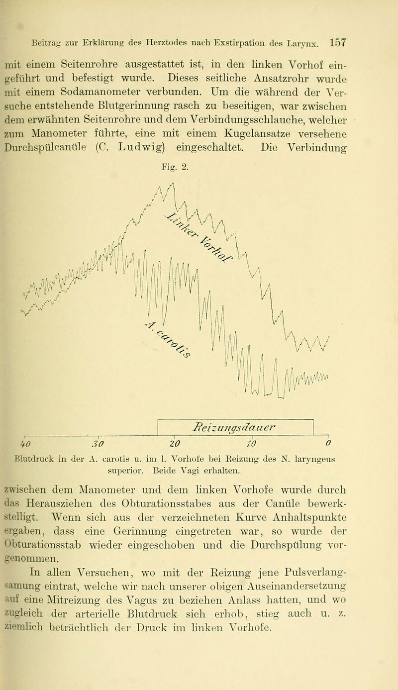 mit einem Seitenrohre ausgestattet ist, in den linken Vorhof ein- geführt und befestigt wurde. Dieses seitliche Ansatzrohr wurde mit einem Sodamanometer verbunden. Um die während der Ver- suche entstehende Blutgerinnung rasch zu beseitigen, war zwischen dem erwähnten Seitenrohre und dem Verbindungsschlauche, welcher zum Manometer führte, eine mit einem Kugelansatze versehene Durchspülcanüle (C. Ludwig) eingeschaltet. Die Verbindung Fig. 2. 7 'v' f Reiz tmgsrfa u er W 30 20 10 O Blutdruck in der A. carotis u. im 1. Vorhofe bei Reizung des N. laryngeus superior. Beide Vagi erhalten. zwischen dem Manometer und dem linken Vorhofe wurde durch das Herausziehen des Obturationsstabes aus der Canüle bewerk- stelligt. Wenn sich aus der verzeichneten Kurve Anhaltspunkte ergaben, dass eine Gerinnung eingetreten war, so wurde der Obturationsstab wieder eingeschoben und die Durchspülung vor- genommen. In allen Versuchen, wo mit der Reizung jene Pulsverlang- •imung eintrat, welche wir nach unserer obigen Auseinandersetzung nt eine Mitreizung des Vagus zu beziehen Anlass hatten, und wo zugleich der arterielle Blutdruck sich erhob, stieg auch u. z. ziemlich beträchtlich der Druck im linken Vorhofe.