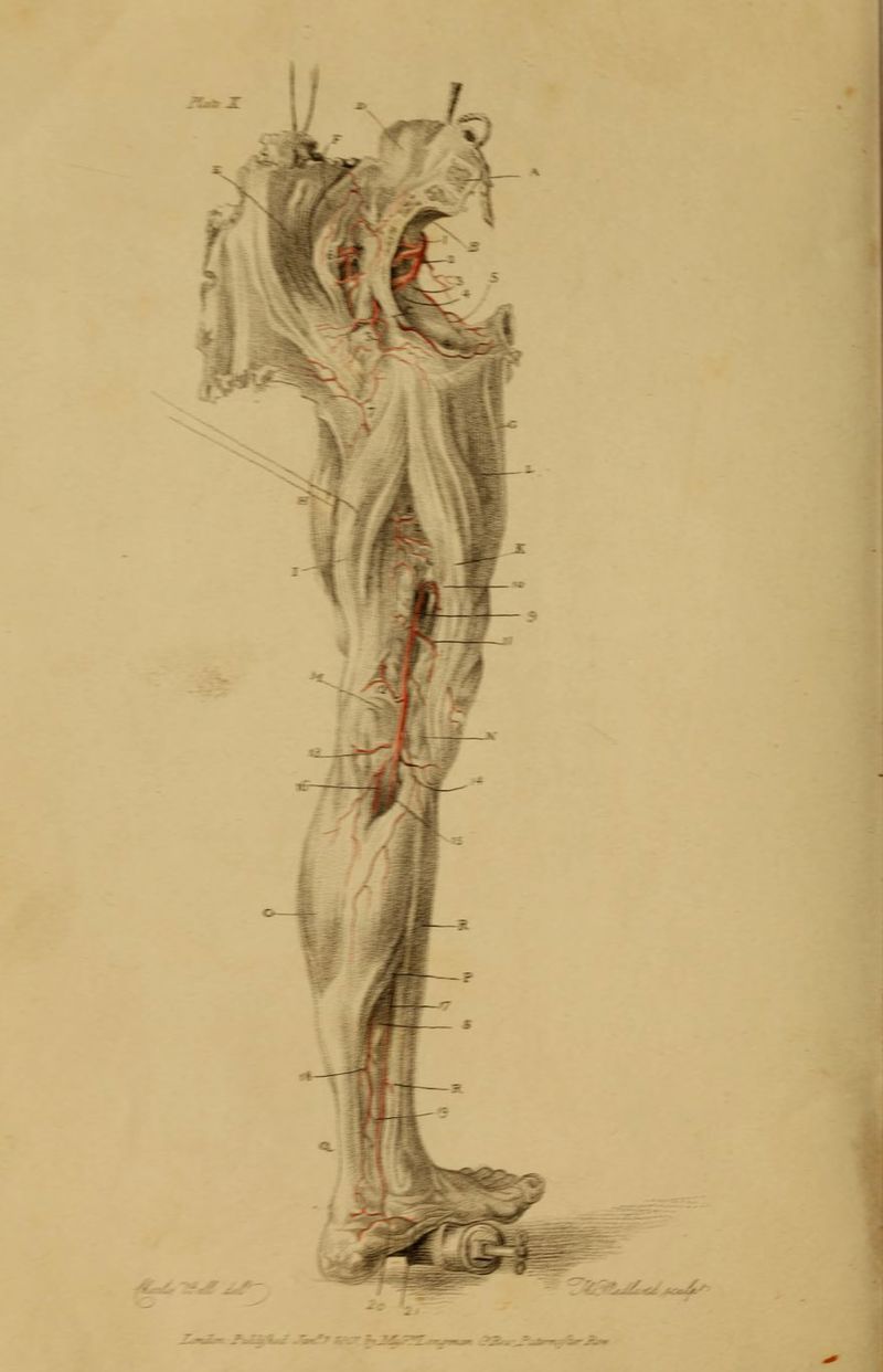 / - -I \l ~l -^ w \ -