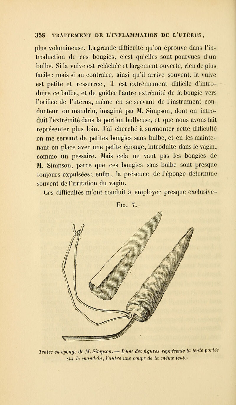 plus volumineuse. La grande difficulté qu'on éprouve dans l'in- troduction de ces bougies, c'est qu'elles sont pourvues d'un bulbe. Si la vulve est relâchée et largement ouverte, rien de plus facile ; mais si au contraire, ainsi qu'il arrive souvent, la vulve est petite et resserrée, il est extrêmement difficile d'intro- duire ce bulbe, et de guider l'autre extrémité de la bougie vers l'orifice de l'utérus, même en se servant de l'instrument con- ducteur ou mandrin, imaginé par M. Simpson, dont on intro- duit l'extrémité dans la portion bulbeuse, et que nous avons fait représenter plus loin. J'ai cherché à surmonter cette difficulté en me servant de petites bougies sans bulbe, et en les mainte- nant en place avec une petite éponge, introduite dans le vagin, comme un pessaire. Mais cela ne vaut pas les bougies de M. Simpson, parce que ces bougies sans bulbe sont presque toujours expulsées; enfin, la présence de l'éponge détermine souvent de l'irritation du vagin. Ces difficultés m'ont conduit à employer presque exclusive- FiG. 7. Tentes en éponge de M. Simpson. — L'une des figures représente la tente portée sur le mandrin, l'autre une coupe de la même tente.