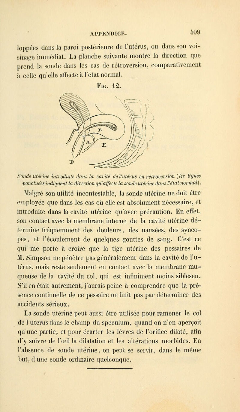 -409 loppées dans la paroi postérieure de l'utérus, ou dans son voi- sinage immédiat. La planche suivante montre la direction que prend la sonde dans les cas de rétroversion, comparativement à celle qu'elle affecte à l'état normal. FiG. 12. Sonde utérine introduite dans la cavité de l'utérus en rétroversion ( les lignes ponctuées indiquent la direction qu'affecte la sonde utérine dans l'état normal]. Malgré son utilité incontestable, la sonde utérine ne doit être employée que dans les cas où elle est absolument nécessaire, et introduite dans la cavité utérine qu'avec précaution. En effet, son contact avec la membrane interne de la cavité utérine dé- termine fréquemment des douleurs, des nausées, des synco- pes, et l'écoulement de quelques gouttes de sang. C'est ce qui me porte à croire que la tige utérine des pessaires de M. Simpson ne pénètre pas généralement dans la cavité de l'u- lérus, mais reste seulement en contact avec la membrane mu- queuse de la cavité du col, qui est infiniment moins siblesen. S'il en était autrement, j'aurais peine à comprendre que la pré- sence continuelle de ce pessaire ne finît pas par déterminer des accidents sérieux. La sonde utérine peut aussi être utilisée pour ramener le col de l'utérus dans le champ du spéculum, quand on n'en aperçoit qu'une partie, et pour écarter les lèvres de l'orifice dilaté, afin d'y suivre de l'œil la dilatation et les altérations morbides. En l'absence de sonde utérine, on peut se servir, dans le même but, d'une sonde ordinaire quelconque.