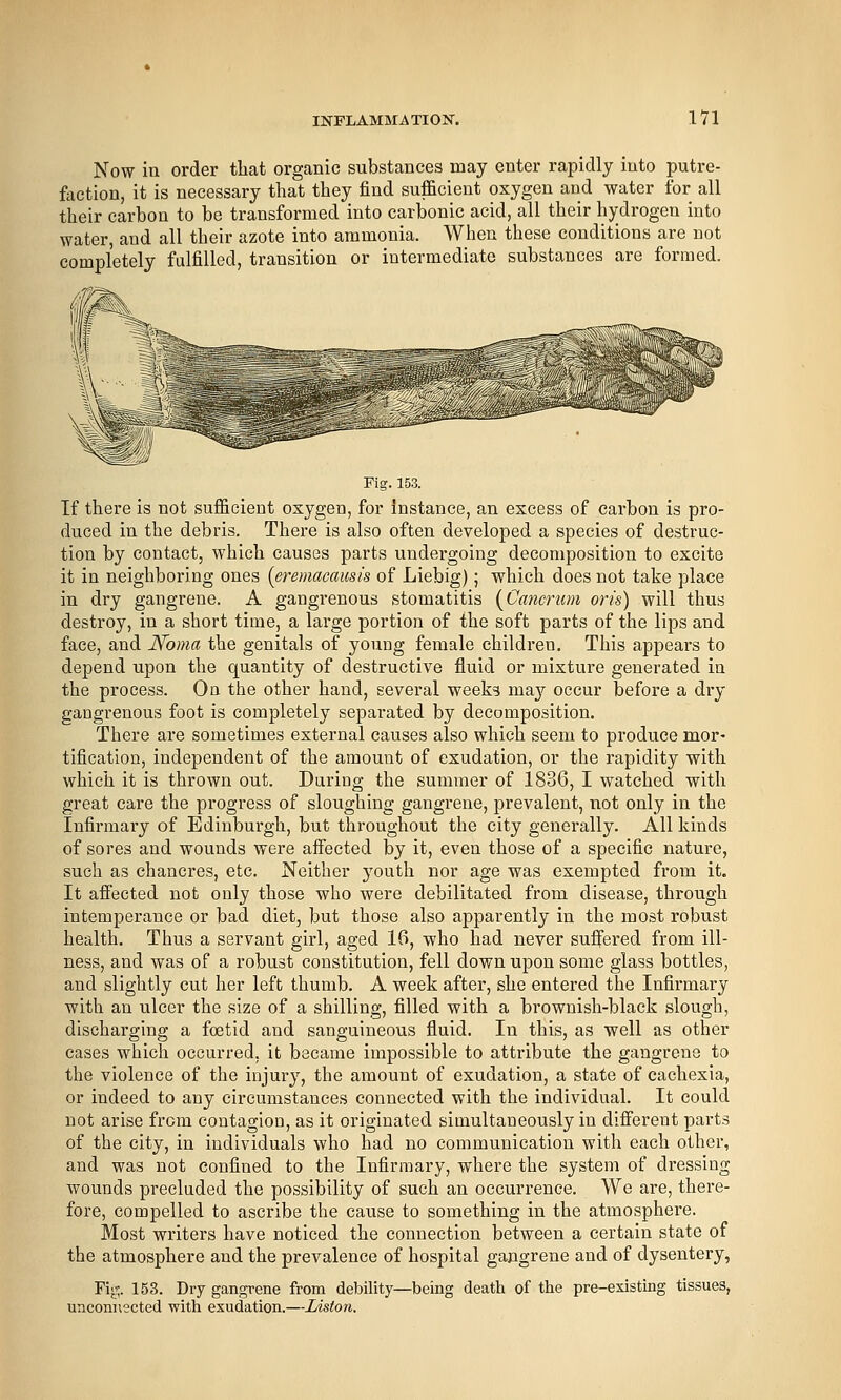 Now in order that organic substances may enter rapidly into putre- faction, it is necessary that they find sufficient oxygen and water for all their carbon to be transformed into carbonic acid, all their hydrogen into water, and all their azote into ammonia. When these conditions are not completely fulfilled, transition or intermediate substances are formed. Fig. 153. If there is not sufficient oxygen, for instance, an excess of carbon is pro- duced in the debris. There is also often developed a species of destruc- tion by contact, which causes parts undergoing decomposition to excite it in neighboring ones {eremacausis of Liebig); which does not take place in dry gangrene. A gangrenous stomatitis [Cancrum oris) will thus destroy, in a short time, a large portion of the soft parts of the lips and face, and Noma the genitals of young female children. This appears to depend upon the quantity of destructive fluid or mixture generated in the process. On the other hand, several weeks m3.j occur before a dry gangrenous foot is completely separated by decomposition. There are sometimes external causes also which seem to produce mor- tification, independent of the amount of exudation, or the rapidity with which it is thrown out. During the summer of 1836, I watched with great care the progress of sloughing gangrene, prevalent, not only in the Infirmary of Edinburgh, but throughout the city generally. All kinds of sores and wounds were affiected by it, even those of a specific nature, such as chancres, etc. Neither youth nor age was exempted from it. It aff'ected not only those who were debilitated from disease, through intemperance or bad diet, but those also apparently in the most robust health. Thus a servant girl, aged 16, who had never suffered from ill- ness, and was of a robust constitution, fell down upon some glass bottles, and slightly cut her left thumb. A week after, she entered the Infirmary with an ulcer the size of a shilling, filled with a brownish-black slough, discharging a foetid and sanguineous fluid. In this, as well as other cases which occurred, it became impossible to attribute the gangrene to the violence of the injurj^, the amount of exudation, a state of cachexia, or indeed to any circumstances connected with the individual. It could not arise from contagion, as it originated simultaneously in different parts of the city, in individuals who had no communication with each other, and was not confined to the Infirmary, where the system of dressing wounds precluded the possibility of such an occurrence. We are, there- fore, compelled to ascribe the cause to something in the atmosphere. Most writers have noticed the connection between a certain state of the atmosphere and the prevalence of hospital gangrene and of dysentery, Fig. 153. Dry gangrene from debility—being death of the pre-existmg tissues, unconnected with exudation.—Zistort.