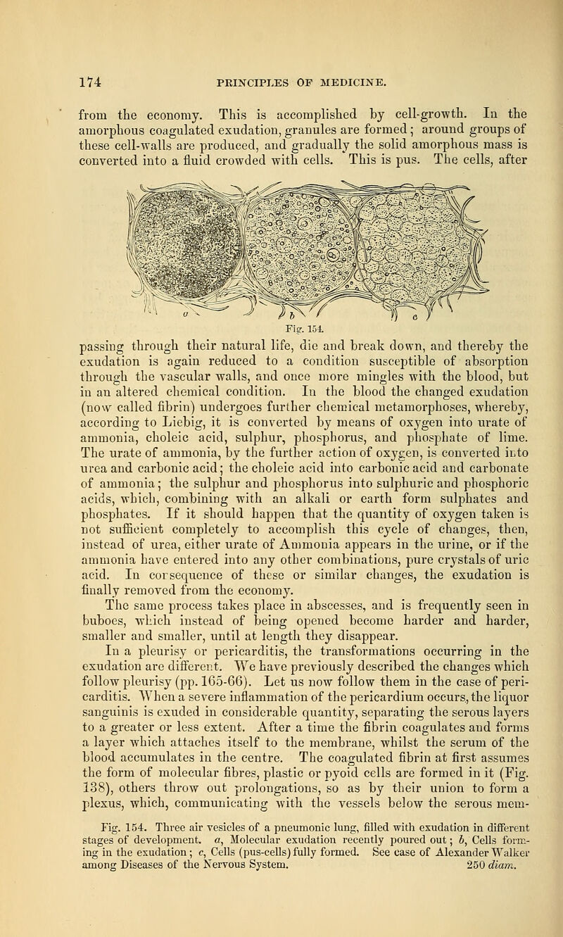 from the economy. This is accomplished by cell-growth. In the amorphous coagulated exudation, granules are formed; around groups of these cell-walls are produced, and gradually the solid amorphous mass is converted into a fluid crowded with cells. This is pus. The cells, after Fig. 154. passing through their natural life, die and break down, and thereby the exudation is again reduced to a condition susceptible of absorption through the vascular walls, and once more mingles with the blood, but in an altered chemical condition. In the blood the changed exudation (now called fibrin) undergoes further chemical metamorphoses, whereby, according to Liebig, it is converted by means of oxygen into urate of ammonia, choleic acid, sulphur, phosphorus, and phosphate of lime. The urate of ammonia, by the further action of oxygen, is converted into urea and carbonic acid; the choleic acid into carbonic acid and carbonate of ammonia; the sulphur and phosphorus into sulphuric and phosphoric acids, which, combining with an alkali or earth form sulphates and phosphates. If it should happen that the quantity of oxygen taken is not sufficient completely to accomplish this cycle of changes, then, instead of urea, either urate of Ammonia appears in the urine, or if the ammonia have entered into any other combinations, pure crystals of uric acid. In cor sequence of these or similar changes, the exudation is finally removed from the economy. The same process takes place in abscesses, and is frequently seen in buboes, which instead of being opened become harder and harder, smaller and smaller, until at length they disappear. In a pleurisy or pericarditis, the transformations occurring in the exudation are different. We have previously described the changes which follow pleurisy (pp. 165-66). Let us now follow them in the case of peri- carditis. When a severe inflammation of the pericardium occurs, the liquor sanguinis is exuded in considerable quantity, separating the serous layers to a greater or less extent. After a time the fibrin coagulates and forms a layer which attaches itself to the membrane, whilst the serum of the blood accumulates in the centre. The coagulated fibrin at first assumes the form of molecular fibres, plastic or pyoid cells are formed in it (Fig. 138), others throw out prolongations, so as by their union to form a plexus, which, communicating with the vessels below the serous mem- Fig. 154. Three air vesicles of a pneumonic lung, filled with exudation in different stages of development, a, Molecular exudation recently poured out; b, Cells form- ing in the exudation; c, Cells (pus-cells) fully formed. See case of Alexander Walker among Diseases of the Nervous System. 250 diam.