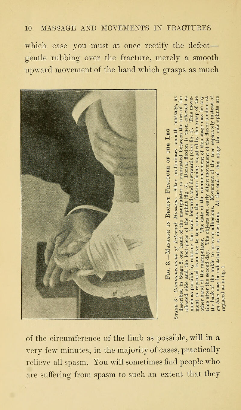 which case you must at once rectify the defect— gentle rubbing over the fracture, merely a smooth upward movement of the hand which grasps as much ti A _, 0 -» c3 CO rfl • i—i _ CD O CD rrt -d ^TrCi <3 CD c3 co b-Q- o S bo » S s< J o » ;«* S-l © CO . rg CD S ,i3, 53 'S CO IT3 I ■ P : so c3 ,3 a, H 5 J 13 • « S S? j3 • tf ^ ,.OM S.2 a ^ CO _, C JS co « .^ V^ T1 s cp c3 S t3 S ffi. ,£5 G 8 C s . co CD CD cp! C3_ <n-3 -° ri S a «2 a 8. ° -S * ^-s gi3c3Sfio43^3<»S cc TO of the circumference of the limb as possible, will in a very few minutes, in the majority of cases, practically relieve all spasm. You will sometimes find people who are suffering from spasm to such an extent that they