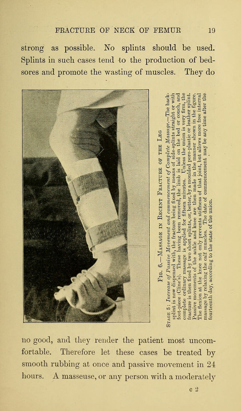 strong as possible. No splints should be used. Splints in such cases tend to the production of bed- sores and promote the wasting of muscles. They do ^5^^ be' CD c3 d . * a o s vS n -a 43' a s _2 s eg ~£ c3£ 6 | fts-8 M S ■ ft ■; « aR. 61 . is .5 <a co J? CD *3 . o co d ® eS 5 O Stl 2 co •u CB-9 « H -P. §^ CD g >,g § ® g tT a ft «is - ,2 J! ft CK cd fl S53 § M> $ « 8 g 2-2^= £ 1-° 2t °-» ft i! CD J a s a g CD O Sfi§'fl 43^ P m CD CD CO ^ ^ |> c8 O O ^3 £ CO ^ -*-> CD CD g IS CD cS « CDH cS-0^ Ph 2 gfl° «>.2 CO * CD § ^. s .a s | £ £0^43 > 5 o _ o ' ft  CD H co S_g fl § s a. 3 fD d o P<o o .S CD C S CD SO CD &7? p.£c3 c3 a> c3 c3 =spm .d ce H S. no good, and they render the patient most uncom- fortable. Therefore let these cases be treated by smooth rubbing at once and passive movement in 24 hours. A masseuse, or any person with a moderately c 2