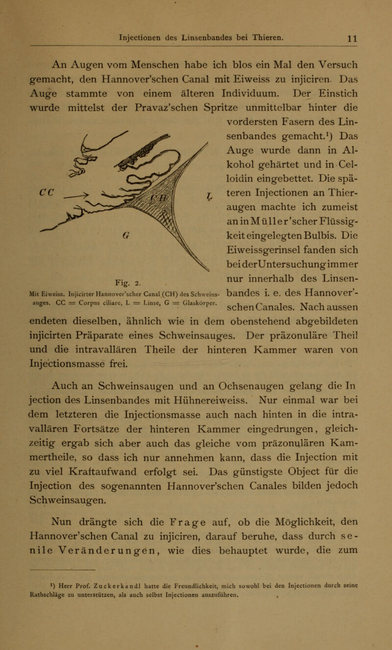 An Augen vom Menschen habe ich blos ein Mal den Versuch gemacht, den Hannoverschen Canal mit Eiweiss zu injiciren. Das Auge stammte von einem älteren Individuum. Der Einstich wurde mittelst der Pravaz'schen Spritze unmittelbar hinter die vordersten Fasern des Lin- senbandes gemacht.1) Das Auge wurde dann in Al- kohol gehärtet und in Cel- loidin eingebettet. Die spä- teren Injectionen an Thier- augen machte ich zumeist an in M ü 11 e r 'scher Flüssig- keit eingelegten Bulbis. Die Eiweissgerinsel fanden sich bei derUntersuchungimmer nur innerhalb des Linsen- bandes i. e. des Hannover- schen Canales. Nach aussen endeten dieselben, ähnlich wie in dem obenstehend abgebildeten injicirten Präparate eines Schweinsauges. Der präzonuläre Theil und die intravallären Theile der hinteren Kammer waren von Injectionsmasse frei. Auch an Schweinsaugen und an Ochsenaugen gelang die In jection des Linsenbandes mit Hühnereiweiss. Nur einmal war bei dem letzteren die Injectionsmasse auch nach hinten in die intra- vallären Fortsätze der hinteren Kammer eingedrungen, gleich- zeitig ergab sich aber auch das gleiche vom präzonulären Kam- mertheile, so dass ich nur annehmen kann, dass die Injection mit zu viel Kraftaufwand erfolgt sei. Das günstigste Object für die Injection des sogenannten Hannoverschen Canales bilden jedoch Schweinsaugen. Nun drängte sich die Frage auf, ob die Möglichkeit, den Hannoverschen Canal zu injiciren, darauf beruhe, dass durch se- nile Veränderungen, wie dies behauptet wurde, die zum Fig. 2. Mit Eiweiss. Injicirter Hannoverscher Canal (CH) des Schweins- auges. CC = Corpus ciliare, L = Linse, G = Glaskörper. J) Herr Prof. Zuckerkandl hatte die Freundlichkeit, mich sowohl bei den Injectionen durch seine Rathschläge zu unterstützen, als auch selbst Injectionen auszuführen.