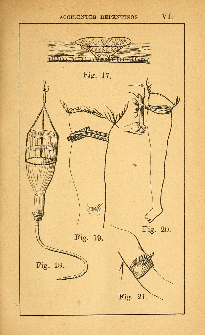 Fig. 17 Fig. 18.