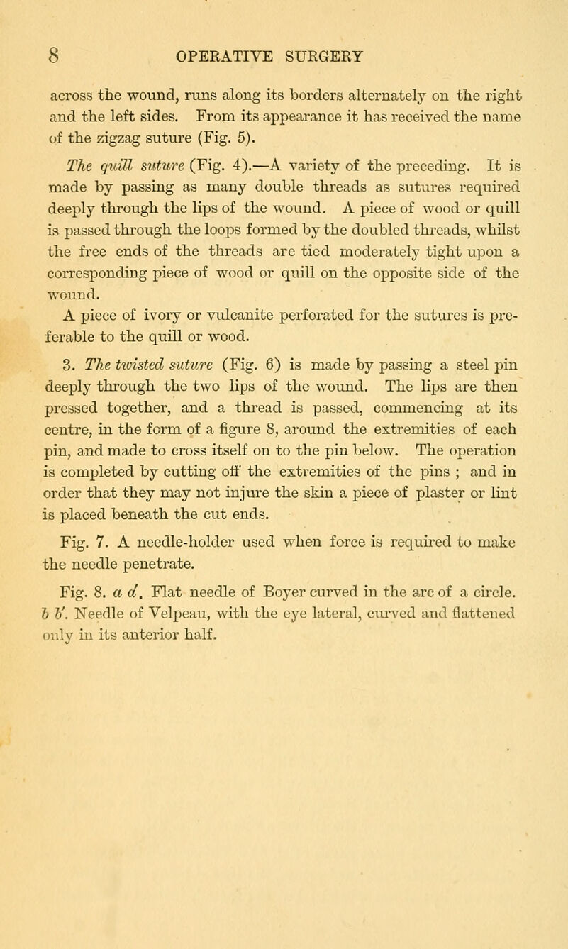 across the wound, runs along its borders alternately on the right and the left sides. From its appearance it has received the name of the zigzag suture (Fig. 5). The quill suture (Fig. 4).—A variety of the preceding. It is made by passing as many double threads as sutures required deeply through the lips of the wound. A piece of wood or quill is passed through the loops formed by the doubled threads, whilst the free ends of the threads are tied moderately tight upon a corresponding piece of wood or quill on the opposite side of the wound. A piece of ivoiy or vulcanite perforated for the sutures is pre- ferable to the quill or wood. 3. The twisted suture (Fig. 6) is made by passing a steel pin deeply through the two lips of the wound. The lips are then pressed together, and a thread is passed, commencing at its centre, in the form of a figure 8, around the extremities of each pin, and made to cross itself on to the pin below. The operation is completed by cutting off the extremities of the pins ; and in order that they may not injure the skin a piece of plaster or lint is placed beneath the cut ends. Fig. 7. A needle-holder used when force is required to make the needle penetrate. Fig. 8. a a. Flat needle of Boyer curved in the arc of a circle. h h'. Needle of Velpeau, with the eye lateral, cuiwed and flattened only in its anterior half.