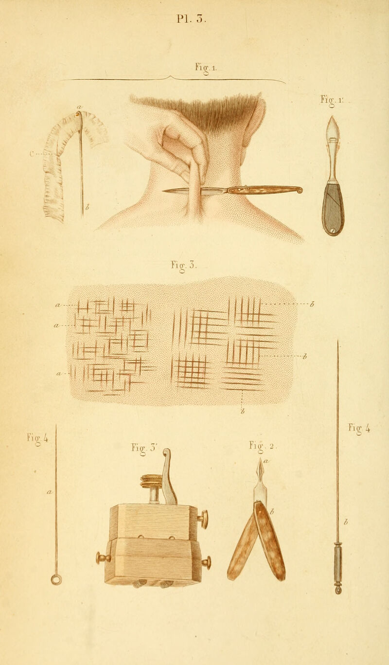 Fi(r. 1. Fig;. 3. Fitr/j Fl^.2.