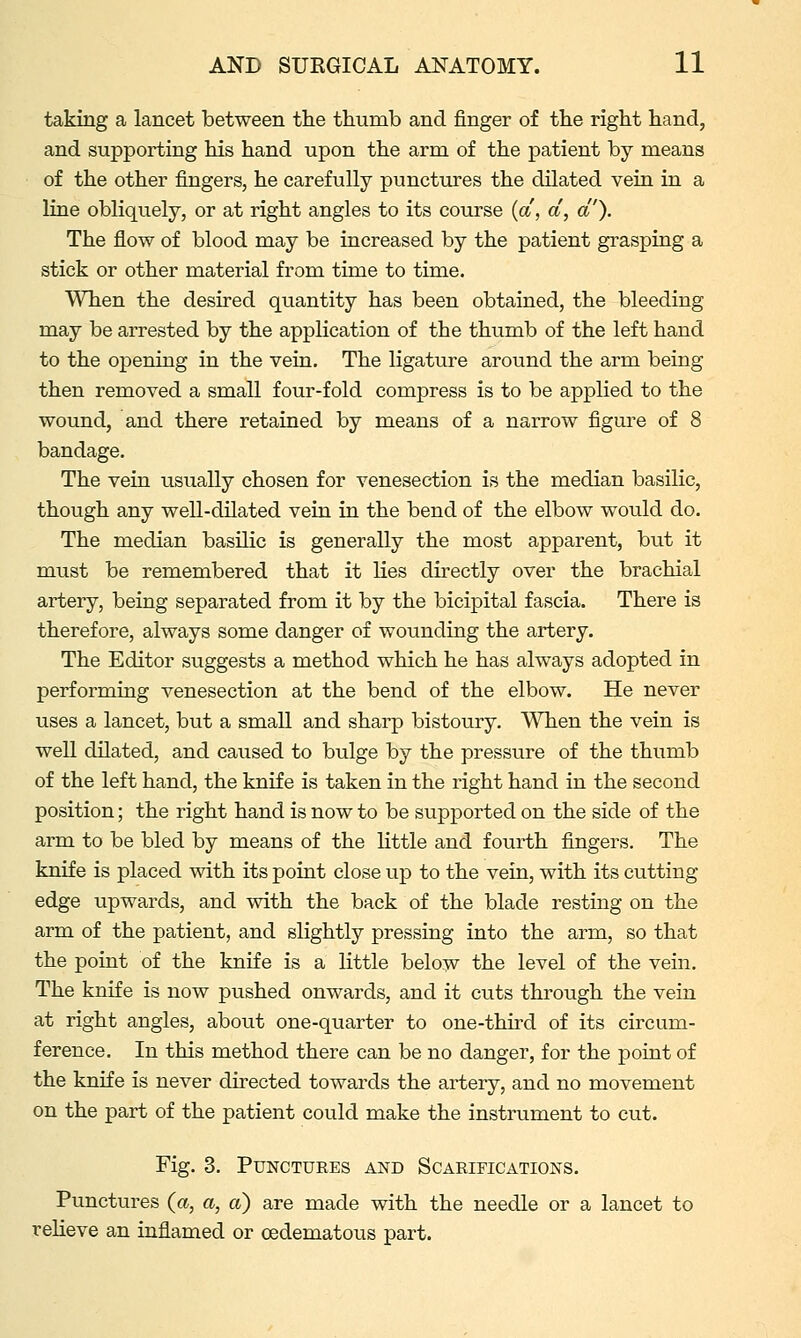 taking a lancet between the thumb and finger of the right hand, and supporting his hand upon the arm of the patient by means of the other fingers, he carefully punctures the dilated vein in a line obliquely, or at right angles to its cotu-se (a, d, a). The flow of blood may be increased by the patient grasping a stick or other material from time to time. When the desired quantity has been obtained, the bleeding may be arrested by the application of the thumb of the left hand to the opening in the vein. The ligature around the arm being then removed a small four-fold compress is to be applied to the wound, and there retained by means of a narrow figm-e of 8 The vein usually chosen for venesection is the median basilic, though any well-dilated vein in the bend of the elbow would do. The median basilic is generally the most apparent, biit it must be remembered that it lies directly over the brachial artery, being separated from it by the bicipital fascia. There is therefore, always some danger of wounding the artery. The Editor suggests a method which he has always adopted in performing venesection at the bend of the elbow. He never uses a lancet, but a small and sharp bistoury. When the vein is well dilated, and caused to bulge by the pressure of the thumb of the left hand, the knife is taken in the right hand in the second position; the right hand is now to be supported on the side of the arm to be bled by means of the little and fourth fingers. The knife is placed with its poiat close up to the vein, with its cutting edge upwards, and with the back of the blade resting on the arm of the patient, and slightly pressing into the arm, so that the point of the knife is a little below the level of the vein. The knife is now pushed onwards, and it cuts through the vein at right angles, about one-quarter to one-third of its circum- ference. In this method there can be no danger, for the point of the knife is never directed towards the artery, and no movement on the part of the patient could make the instrument to cut. Fig. 3. PUNCTUEES AND SCARIFICATIONS. Punctures {a, a, a) are made with the needle or a lancet to relieve an inflamed or oedematous part.