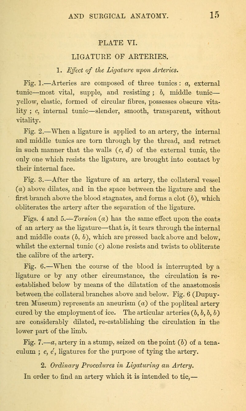 PLATE VI. LIGATURE OF ARTERIES. 1. Effect of the Ligature upon Arteries. Fig. L—Arteries are composed of three tunics : a, external tunic—most vital, supple, and resisting ; 6, middle tunic— yellow, elastic, formed of circular fibres, possesses obscure vita- lity ; c, internal tunic—slender, smooth, transparent, without vitality. Fig. 2.—When a ligature is applied to an artery, the internal and middle tunics are torn through by the thread, and retract in such manner that the walls (c, d) of the external tunic, the only one which resists the ligature, are brought into contact by their internal face. Fig. 3.—After the ligature of an artery, the collateral vessel (a) above dilates, and in the space between the ligature and the first bi-anch above the blood stagnates, and forms a clot (6), which obliterates the artery after the separation of the ligature. Figs. 4 and 5.—Torsion (a) has the same efiect upon the coats of an artery as the ligature—that is, it tears through the internal and middle coats (6, 6), which are pressed back above and below, whilst the external tunic (c) alone resists and twists to obliterate the calibre of the artery. Fig. 6.—When the course of the blood is interrupted by a ligature or by any other circumstance, the circulation is re- estabhshed below by means of the dilatation of the anastomosis between the collateral branches above and below. Fig. 6 (Dupuy- tren Museimi) represents an aneurism (a) of the popliteal artery cured by the employment of ice. The articular arteries (6,6, h, 6) are considerably dilated, re-establishing the circulation in the lower part of the limb. Fig. 7.—a, artery in a stump, seized on the point (6) of a tena- culum ; c, c, ligatiires for the purpose of tying the artery. 2. Ordinary Procedures in Ligaturing an Artery. In order to find an artery which it is intended to tie,—