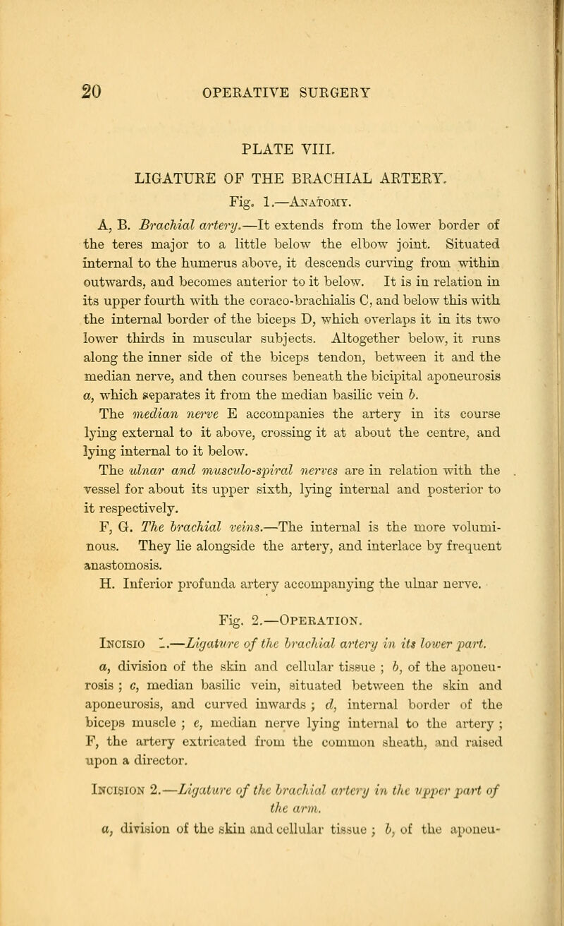 PLATE VIII. LIGATUEE OF THE BRACHIAL ARTERY. Fig. 1.—Anatomy. A, B. Brachial artery,—It extends from the lower border of the teres major to a little below the elbow joint. Situated internal to the humerus above, it descends curving from -^dthia outwards, and becomes anterior to it below. It is in relation in its upper fourth \^'ith the coraco-brachialis C, and below this with the internal border of the biceps D, which overlaps it in its two lower tliirds in muscular subjects. Altogether below, it runs along the inner side of the biceps tendon, between it and the median nerve, and then courses beneath the bicipital aponeurosis a, which separates it from the median basilic vein h. The median nerve E accompanies the artery in its course lying external to it above, crossing it at about the centre, and lying internal to it below. The ulnar and muscido-spiral nerves are in relation with the vessel for about its upper sixth, lying internal and posterior to it respectively. F, G. The brachial veins.—The internal is the more volumi- nous. They lie alongside the artery, and interlace by frequent anastomosis. H. Inferior profunda artery accompanying the ulnar nerve. Fig. 2.—Operation, Incisio 1.—Ligature of the brachial artery in its lower part. a, divisioD of the skin and cellular tissue ; b, of the aponeu- rosis ; c, median basilic vein, situated between the skin and aponeurosis, and curved inwards ; d, internal border of the biceps muscle ; e, median nerve lying iutei-nal to the artery ; F, the artery extricated from the common sheath, and raised upon a director. Incision 2.—Ligature of the brachial artery in the vpper part of the arm. a, division of the skin and cellular tissue ; 6, of the apoueu-