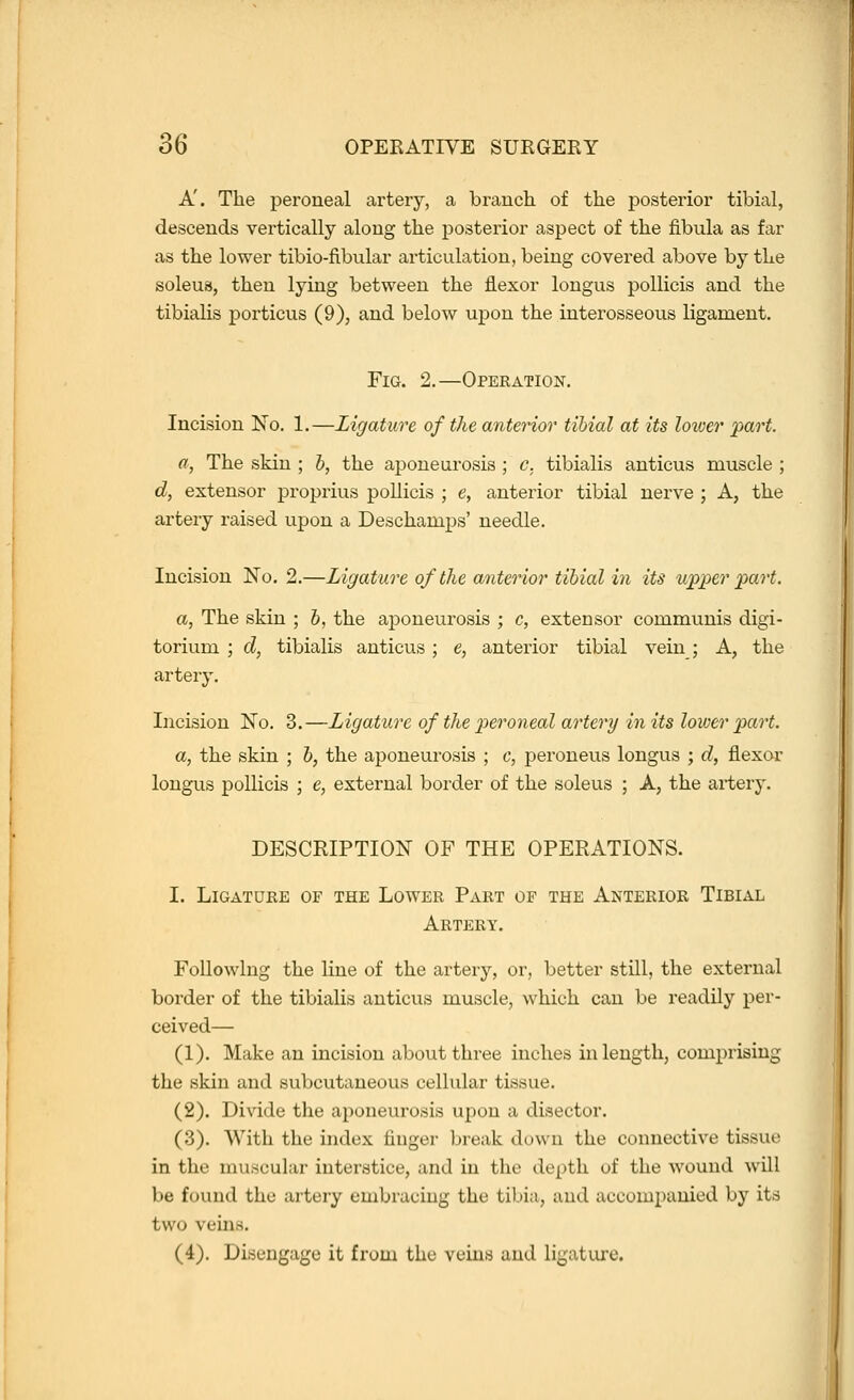 A'. The peroneal artery, a branch of the jDosterior tibial, descends vertically along the posterior aspect of the fibula as far as the lower tibio-fibular articulation, being covered above by the soleus, then lying between the flexor longus poUicis and the tibialis porticus (9), and below upon the interosseous ligament. Fig. 2.—Operation. Incision No. 1.—Ligature of the anterior tibial at its loiver part. a, The skin ; 5, the aponeurosis ; c, tibialis anticus muscle ; d, extensor proprius pollicis ; e, anterior tibial nerve ; A, the artery raised upon a Deschamps' needle. Incision No. 2.—Ligature of the anterior tibial in its upper part. a, The skin ; 6, the aponeurosis ; c, extensor communis digi- torium ; d, tibialis anticus ; e, anterior tibial vein; A, the artery. Incision No. 3.—Ligature of the jyeroneal artery in its lower part, a, the skin ; b, the aponeurosis ; c, peroneus longus ; d, flexor longus pollicis ; e, external border of the soleus ; A, the artery. DESCRIPTION OF THE OPERATIONS. I. Ligature of the Lower Part of the Anterior Tibial Artery. Following the line of the artery, or, better still, the external border of the tibialis anticus muscle, which can be readily per- ceived— (1). Make an incision about three inches in length, comprising the skin and subcutaneous cellular tissue. (2). Divide the aponeurosis upon a disector. (3). A¥ith the index finger break down the connective tissue in the muscular interstice, and in the depth of the wound will be found the artery embracing the tibia, and accompanied by its two veins. (4). Disengage it from the veins and ligatiu-e.