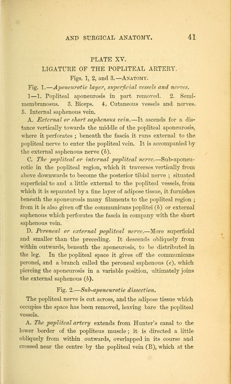 PLATE XV. LIGATURE OF THE POPLITEAL ARTERY. Figs. 1, 2, and 3.—Ajstatomt. Fig. 1.—Aponeurotic layer, superficial vessels and nerves. 1—1. Popliteal aponeurosis in part removed. 2. Semi- membranosus. 3. Biceps. 4. Cutaneous vessels and nerves. 5. Internal saphenous vein. A. External or sliort saphenous vein.—It ascends for a dis- tance vertically towards the middle of the popliteal aponeurosis, where it perforates ; beneath the fascia it runs external to the popliteal nerve to enter the popliteal vein. It is accompanied by the external saphenous nerve (6). C. The popliteal or internal popliteal nerve.—Sub-aponeu- rotic in the popliteal region, which it traverses vertically from above downwards to become the posterior tibial nerve ; situated superficial to and a little external to the popliteal vessels, from which it is separated by a fine layer of adipose tissue, it furnishes beneath the aponeurosis many filaments to the popliteal region ; from it is also given ofi the communicans poplitei (6) or external saphenous which perforates the fascia in company with the short saphenous vein. D, Peroneal or external popliteal nerve.—More superficial and smaller than the preceding. It descends obliquely from within outwards, beneath the aponeurosis, to be distributed in the leg. In the pophteal space it gives off the communicans peronei, and a branch called the peroneal saphenous (e), which piercing the aponeurosis in a variable position, ultimately joins the external saphenous (6). Fig. 2.—Suh-aponeurotie dissection. The popliteal nerve is cut across, and the adipose tissue which occupies the space has been removed, leaving bare the popliteal A. The popliteal artery extends from Hunter's canal to the lower border of the popliteus muscle ; it is directed a little obliquely from within outwards, overlapped in its course and crossed near the centre by the popliteal vein (B), which at the