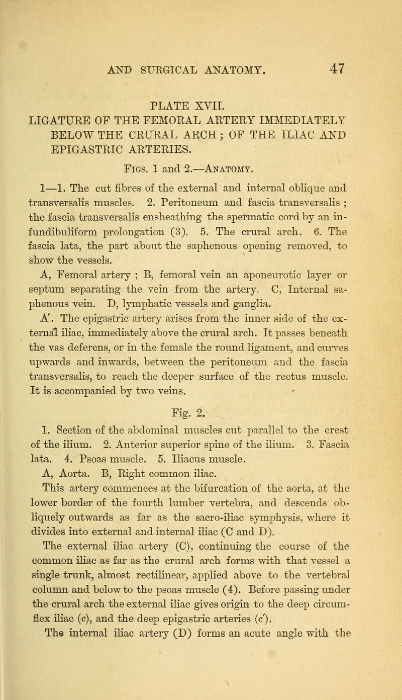 PLATE XVIT. LIGATURE OF THE FEMORAL ARTERY IMMEDIATELY BELOW THE CRURAL ARCH; OF THE ILIAC AND EPIGASTRIC ARTERIES. Figs. 1 and 2.—Anatomy. 1—1. The cut fibres of the external and internal oblique and transversalis muscles. 2. Peritoneum and fascia transversalis ; the fascia transversalis ensheathing the spermatic cord by an in- fundibuliform prolongation (3). 5. The crural arch. 6. The fascia lata, the part about the saphenous opening removed, to show the vessels. A, Femoral artery ; B, femoral vein an aponeurotic layer or septum separating the vein from the artery. C, Internal sa- phenous vein, D, lymphatic vessels and ganglia. A'. The epigastric artery arises from the inner side of the ex- ternal iliac, immediately above the crural arch. It passes beneath the vas deferens, or in the female the rotmd ligament, and curves upwards and inwards, between the peritoneum and the fascia transversalis, to reach the deeper surface of the rectus muscle. It is accompanied by two veins. Fig. 2. 1. Section of the abdominal muscles cut parallel to the crest of the ilium. 2. Anterior superior spine of the ilium. 3. Fascia lata. 4. Psoas muscle. 5. Iliacus muscle. A, Aorta. B, Right common iliac. This artery commences at the bifurcation of the aorta, at the lower border of the fourth lumber vertebra, and descends ob- liquely outwards as far as the sacro-iliac symphysis, where it divides into external and internal Uiac (C and D). The external iliac artery (C), continuing the course of the common iliac as far as the crural arch forms with that vessel a single trunk, almost rectilinear, applied above to the vertebral column and below to the psoas muscle (4). Before passing under the crural arch the external iliac gives origin to the deep circvim- fiex iliac (c), and the deep epigastric arteries (c'). The internal iliac artery (D) forms an acute angle with the