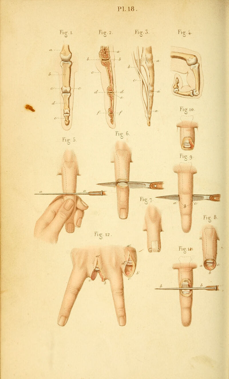 PI. 18.